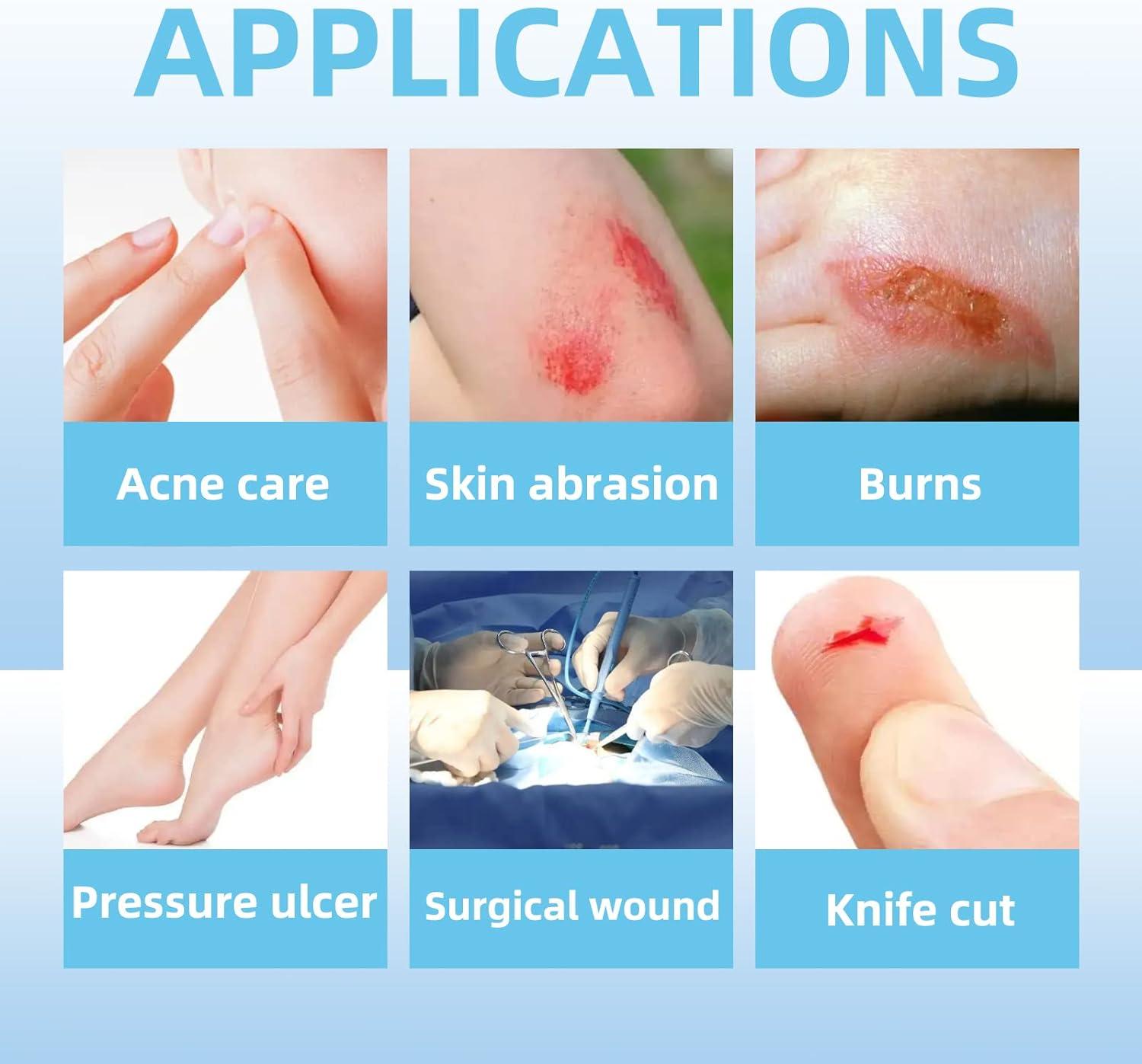 Dr. Med Hydrocolloid Wound Dressing 4x410 Pack/Box Waterproof Adhesive