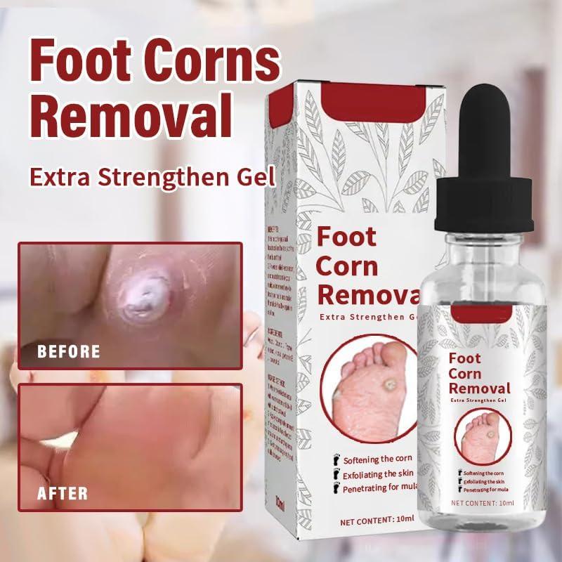 Doxenem Foot Corn Removal Extra Strengthen Gel, Corn Remover Gel for Feet,  Corn Remover Liquid, Callus Remover for Feet Treatment, Easy to Remove  Calluses, for All Skin Type (1pcs) - Yahoo Shopping