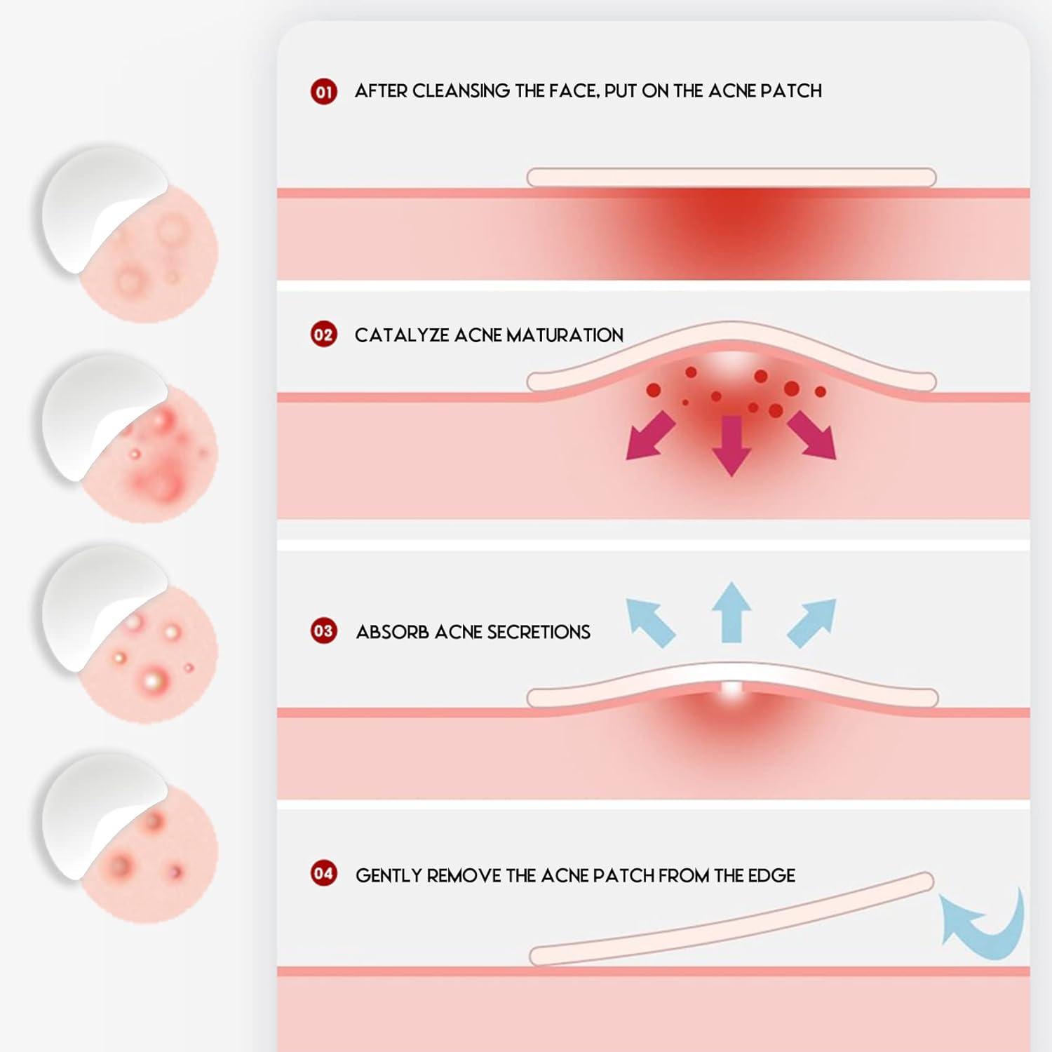 white christmas dresses AnyBand Beauty Hydrocolloid Dressing Dot Patch(42 Count)-Korean Acne P –  Gloryofseoul