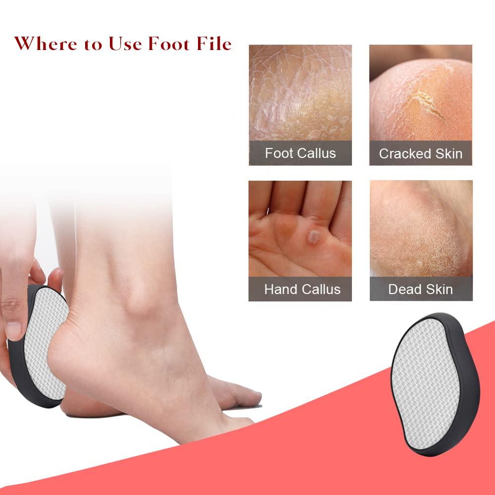 Glass Foot File for Dead Skin, Foot Callus Remover, Glass Foot