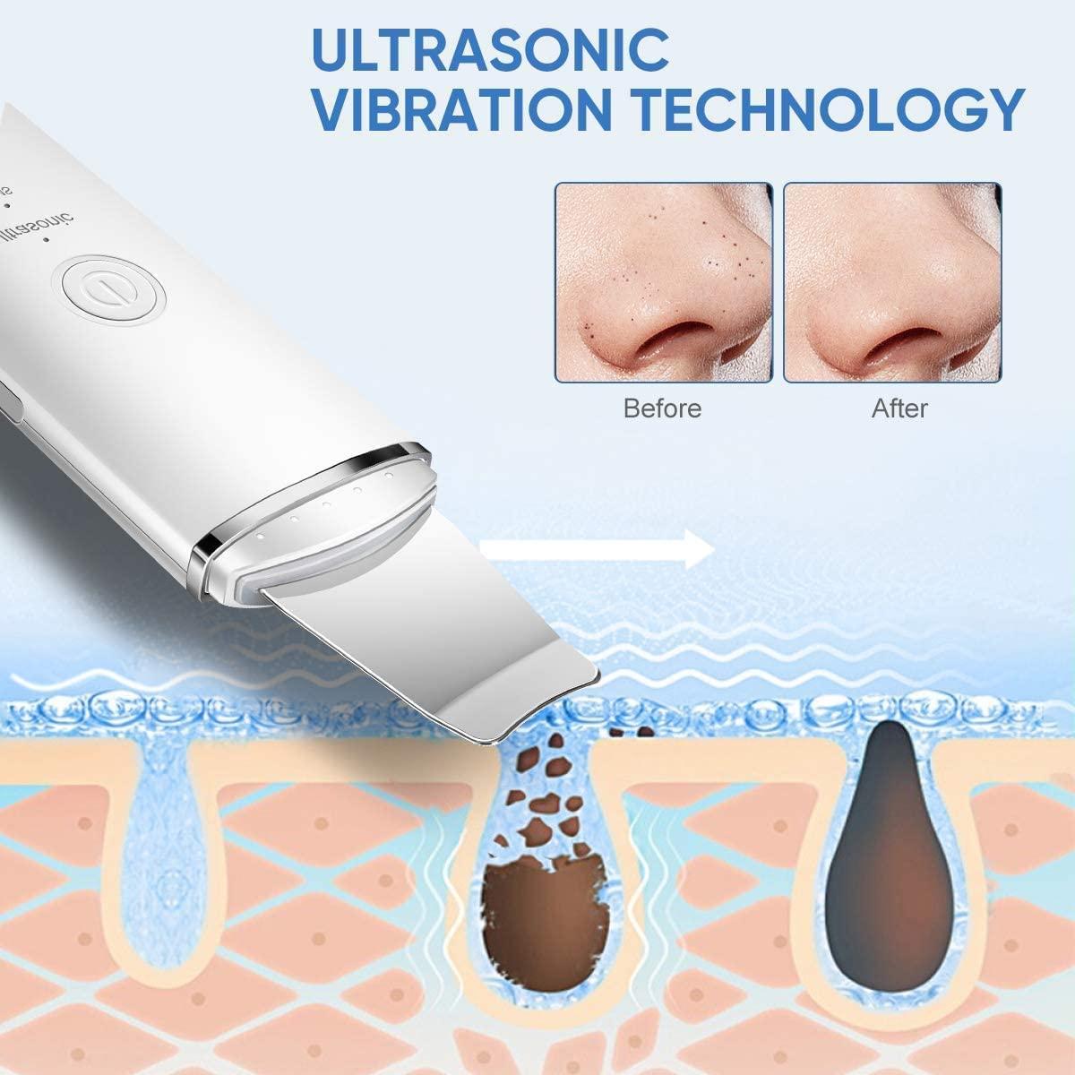 Skin Scrubber Face Spatula, Professional Skin Spatula Blackhead Remover