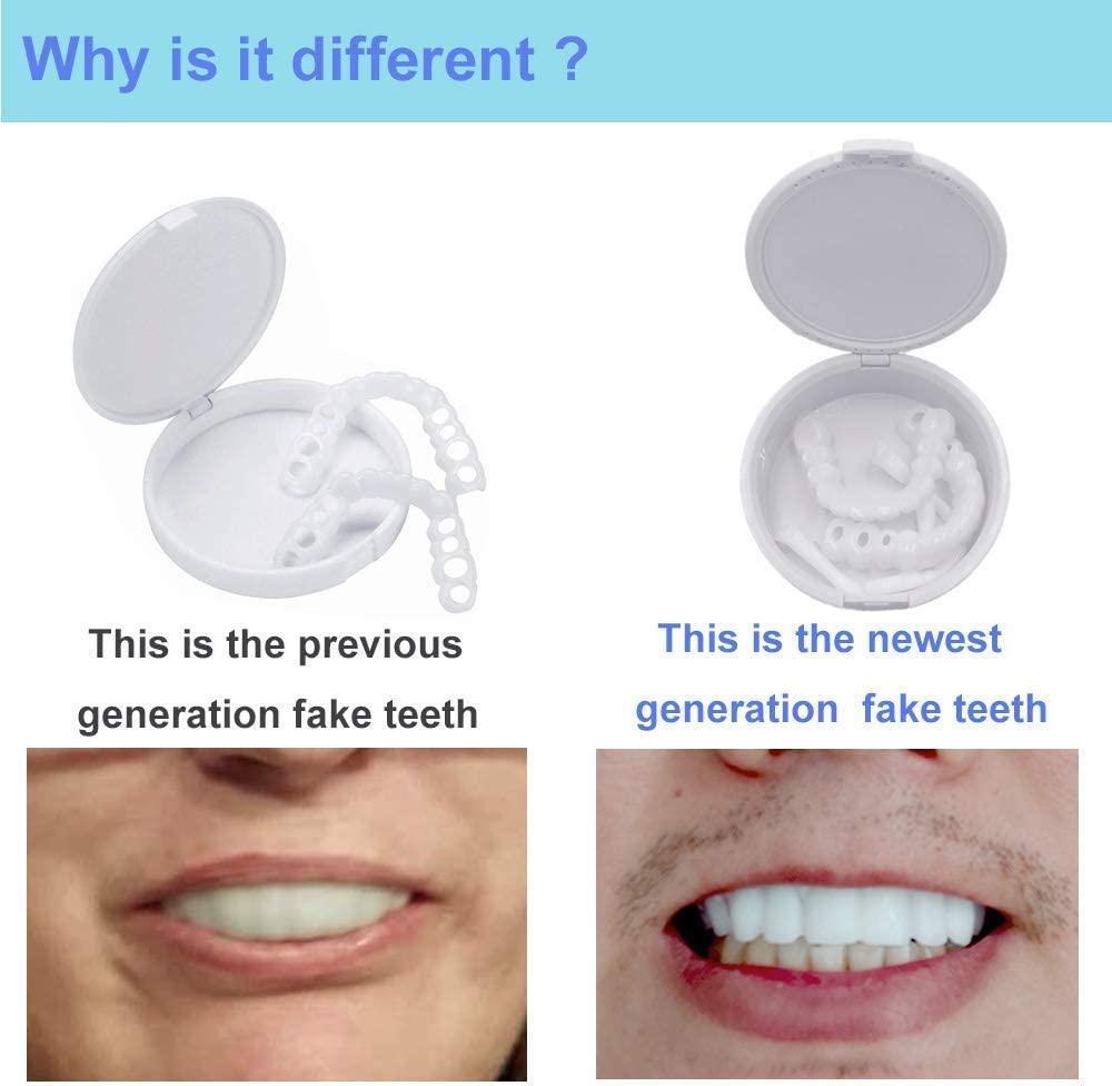 Temporary Denture Teeth SnapOn for Instant Confidence Smile