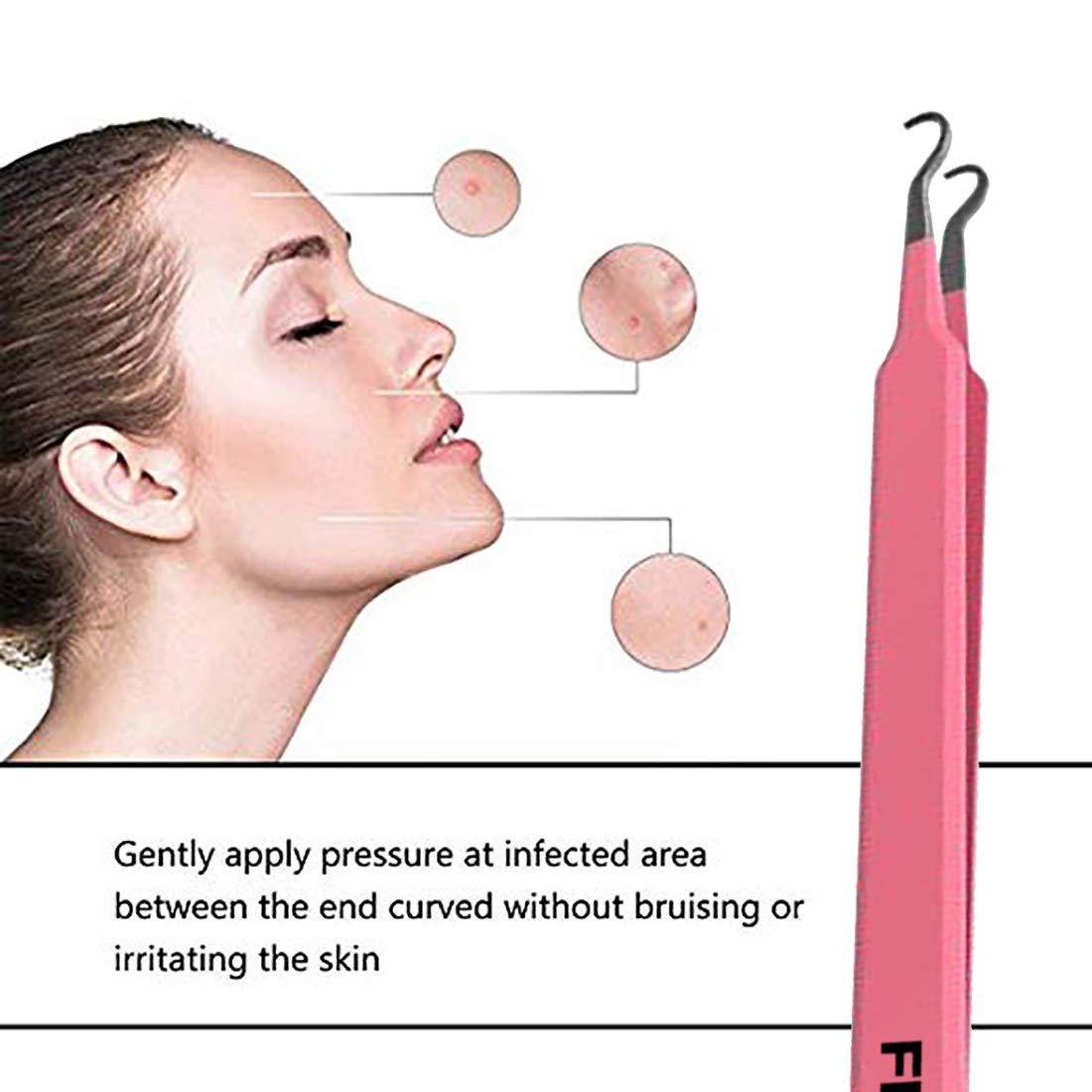 Blackhead Acne Extraction Tweezers FEITA Pro & SurgicalGrade