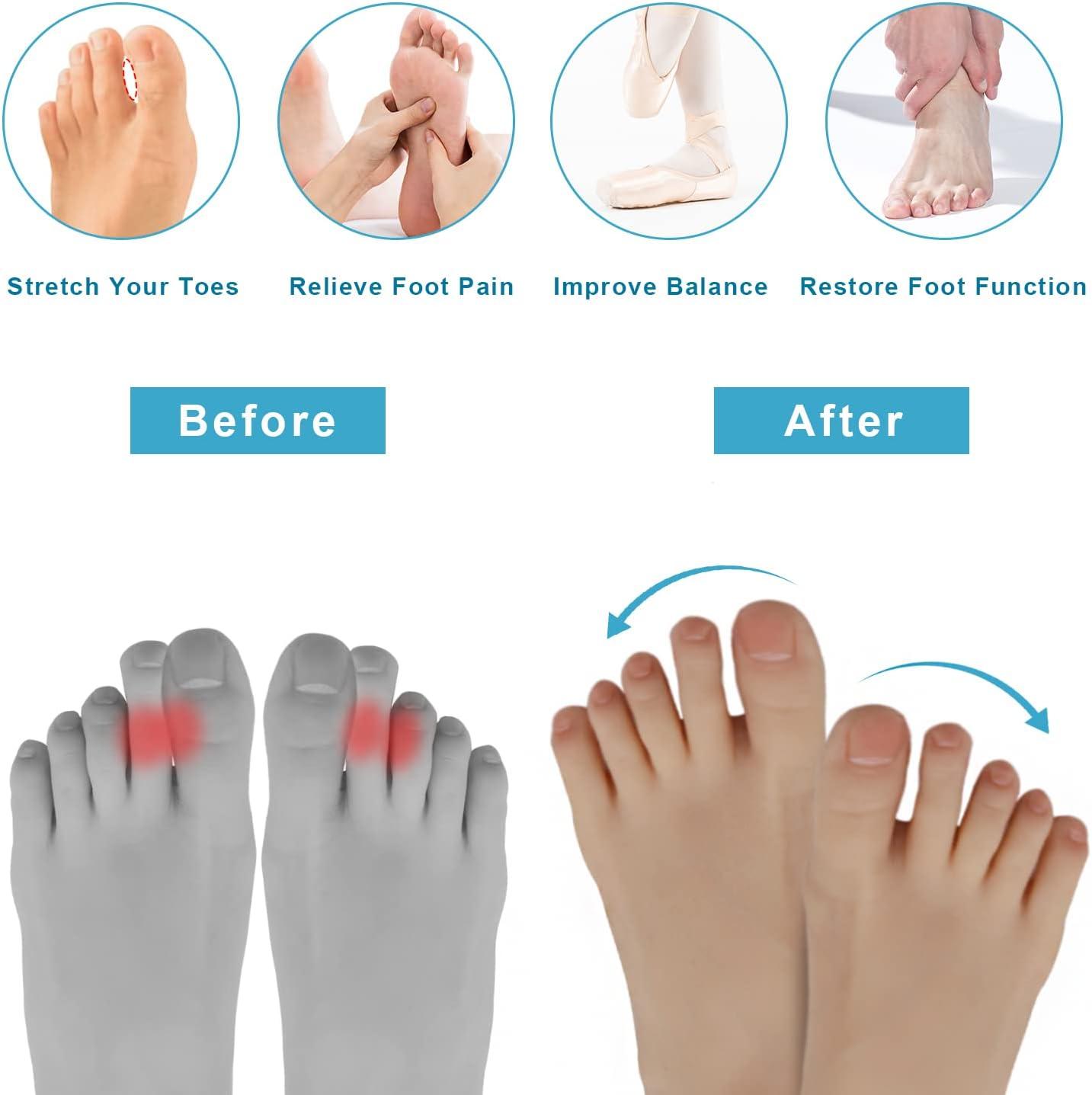 Toe Separators for Women Toe Spacers for Feet Men Fast Pain Relief for  Hammer Toe Plantar Fasciitis and Bunions Toe Stretchers for Yoga Practice  (Medium)