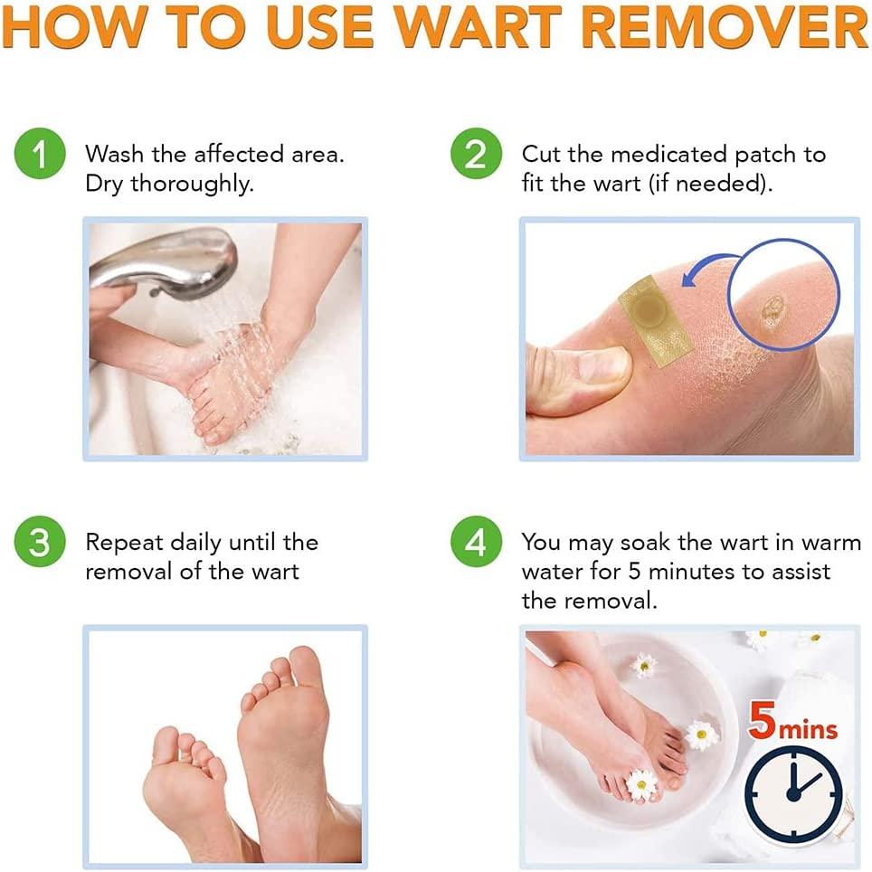 Samsali Wart Remover Pads, Highly Potent Wart Removal Treatment, All