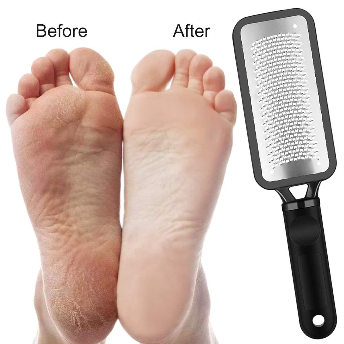 Foot Scraper Pedicure Supplies for Dead Skin Heel File Like Grater