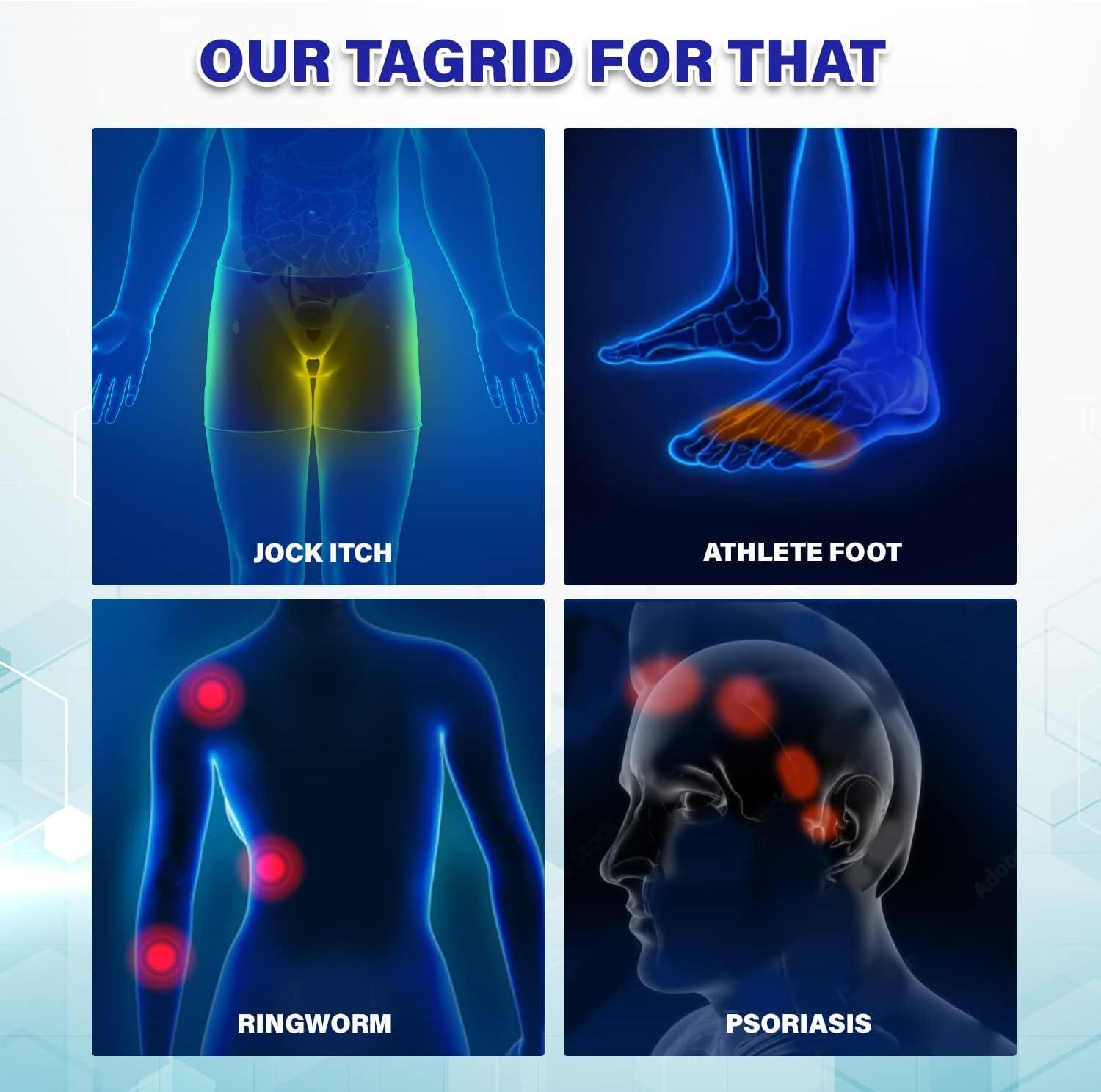 TAGRID Jock Itch Cream 60g Extra Strength Relief for Men & Women
