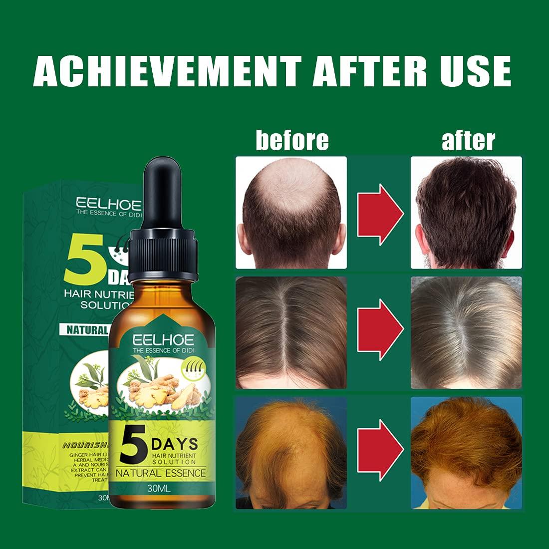 Hair Regrow Ginger Germinal Essential Oil, Ginger Anti Hair Loss Serum