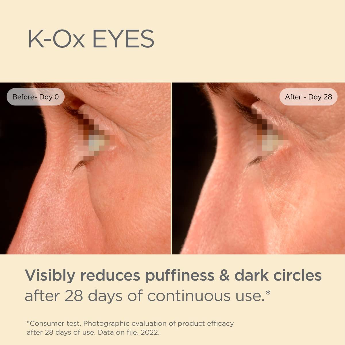 ISDIN KOx UnderEye Brightening Cream for Puffiness and Dark Circles