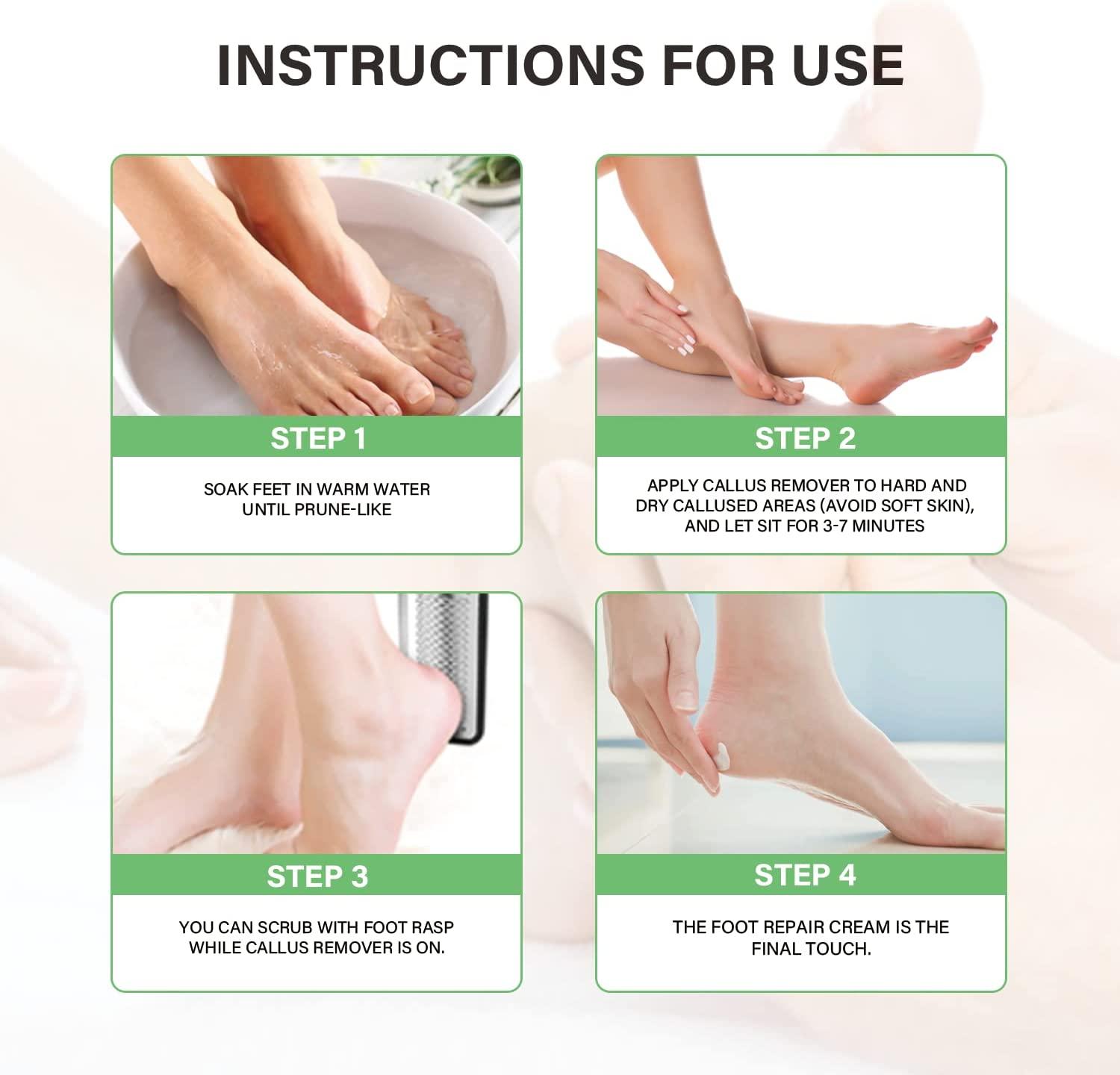 Bella Feet Callus Remover Kit ExtraStrength Callus Remover Gel with