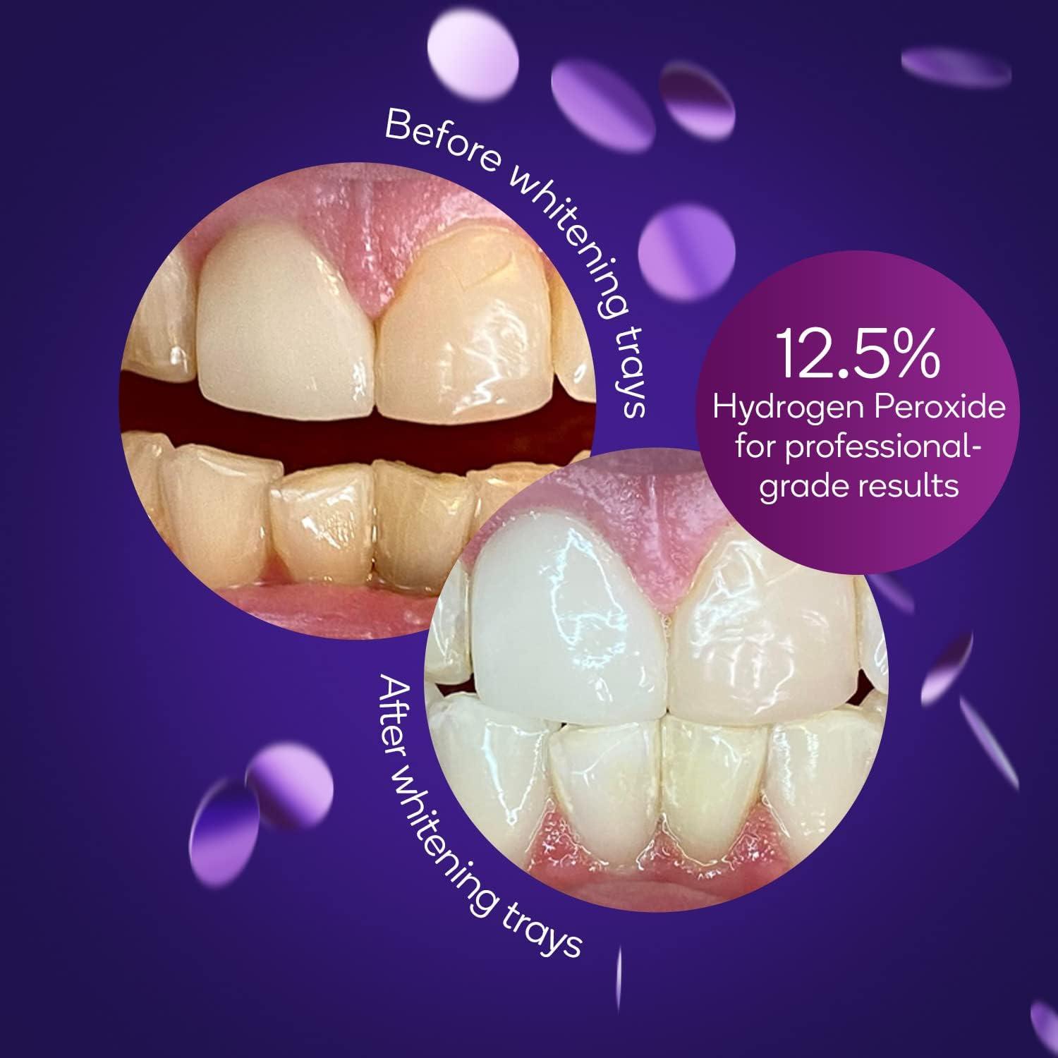 BURST Teeth Whitening Kit Sensitive Teeth Friendly 7 Treatments