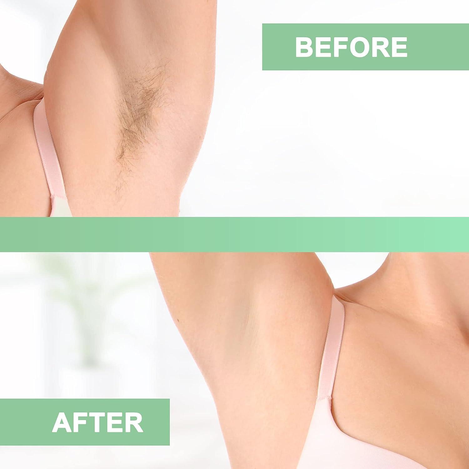 150 Wax Strips - Non Woven Fleece Stripes For Warm Wax And Sugar Paste - Skin-friendly And Tear Resistant Hair Removal For Any Type Of Depilation On The Leg Chest Back Intimate Area And Face - View #7