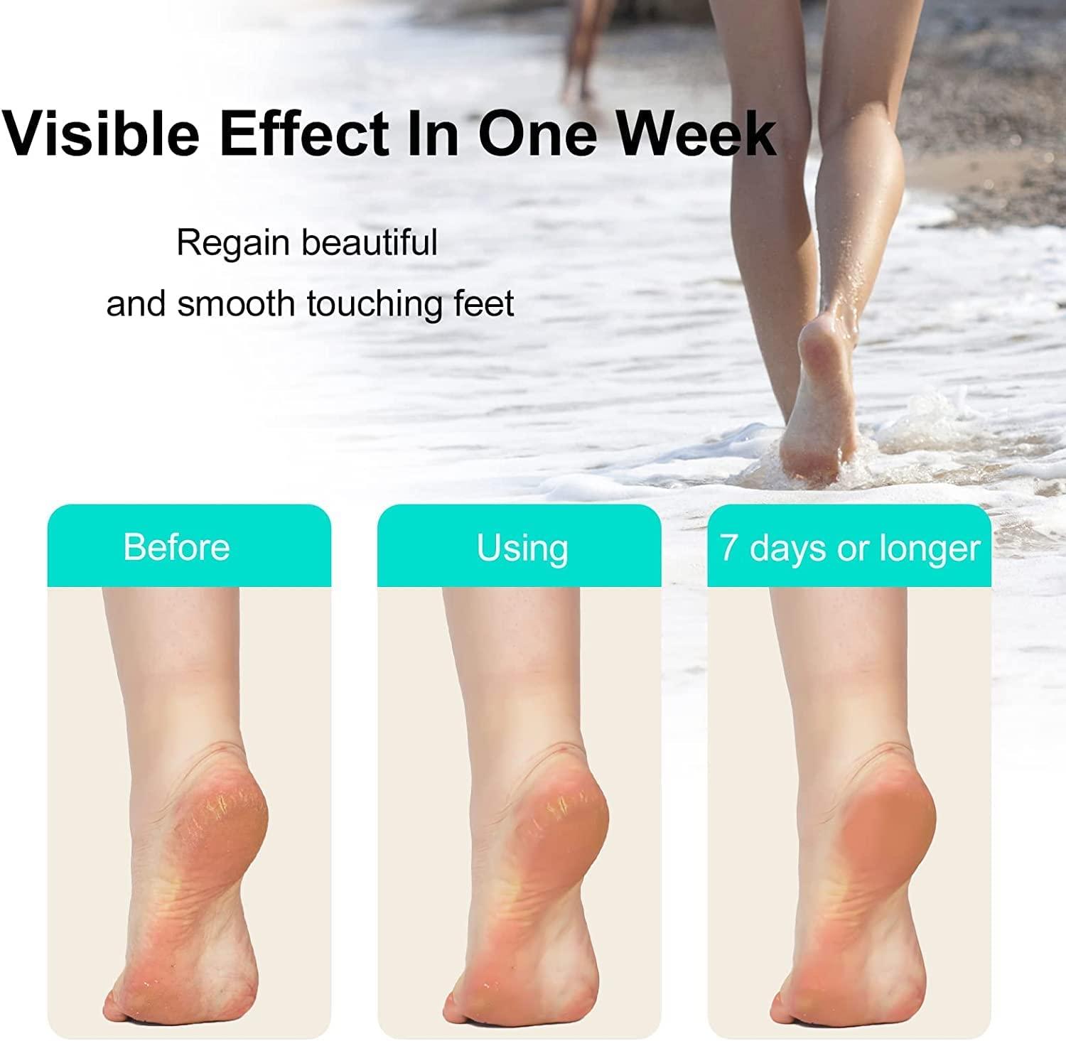 Crystal Foot File Callus Remover for Feet Dead Skin Scrubber