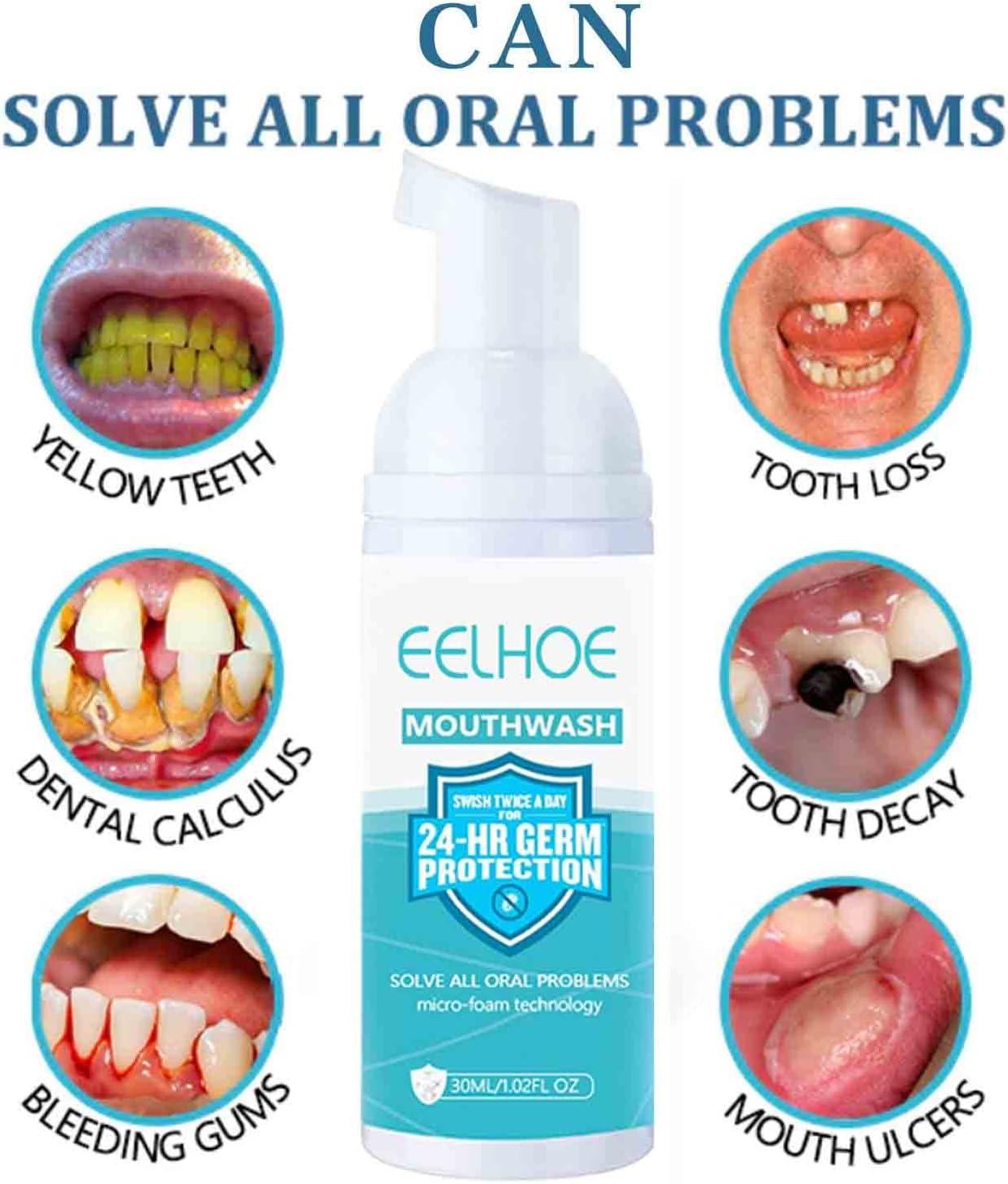 EELHOE Teeth Whitening Foam Toothpaste Stain Removal Mouthwash 30ml