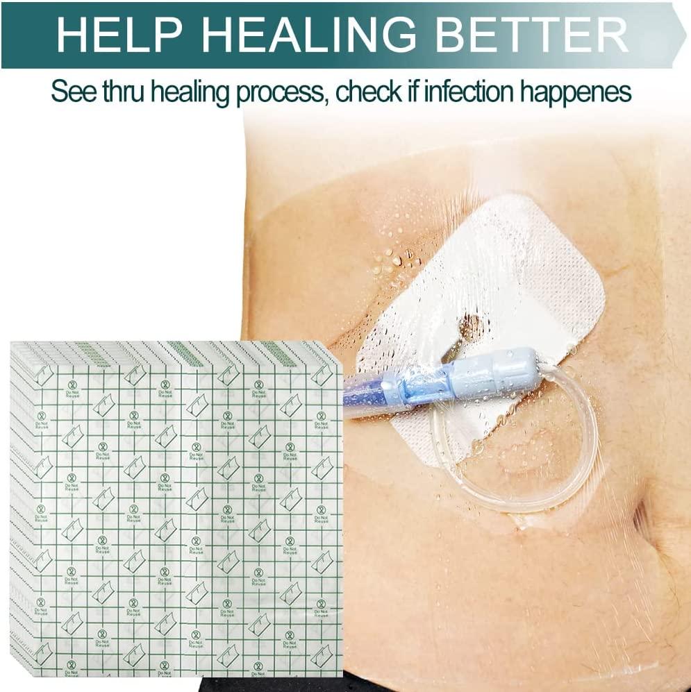 Peritoneal Dialysis Catheter & G Tube Shower Cover 25PCS (8x8