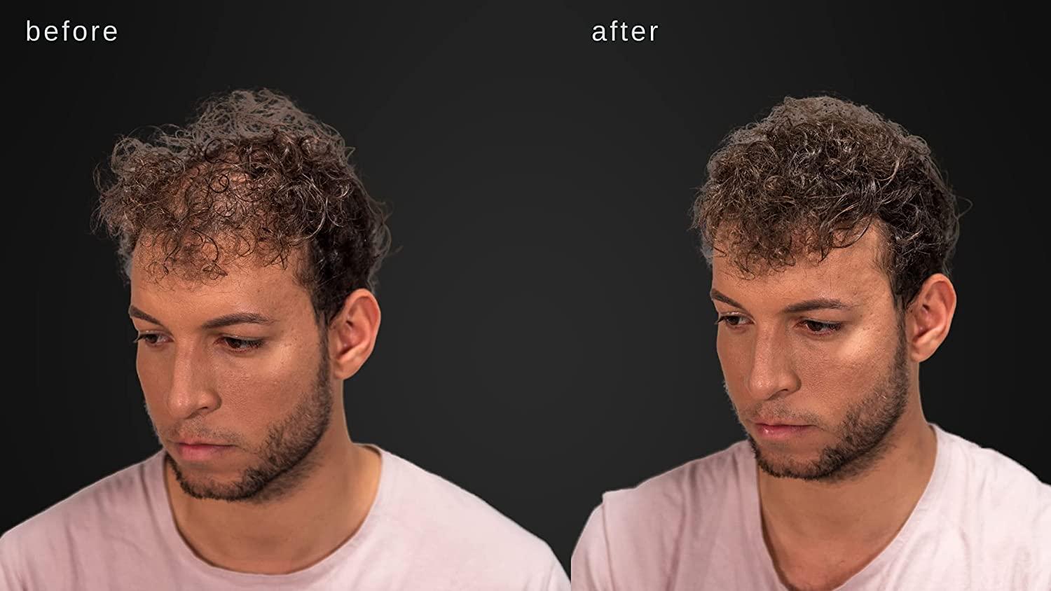 LUXE Hair Thickening Fibers Hypoallergenic, Dermatologist Tested 2