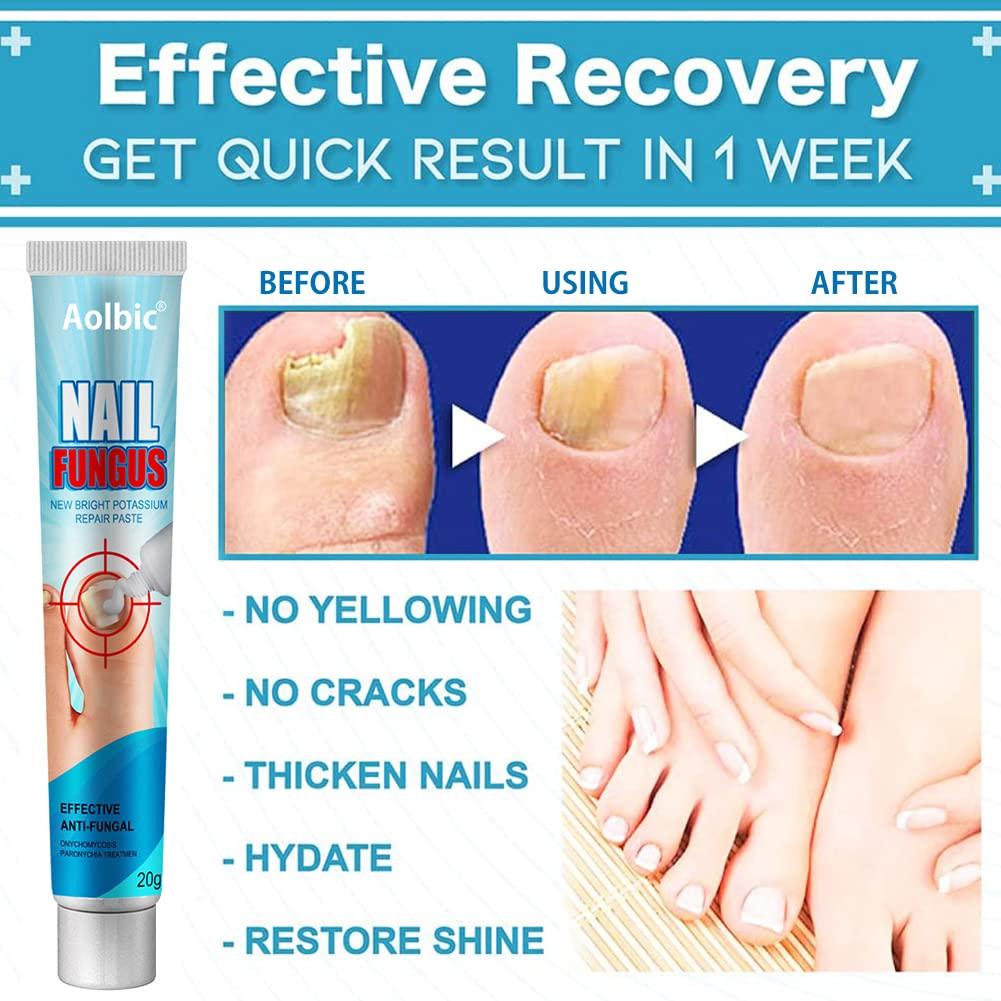 Nail Tek Keratin Nail Treatment 0.5 oz - MAX Beauty Source