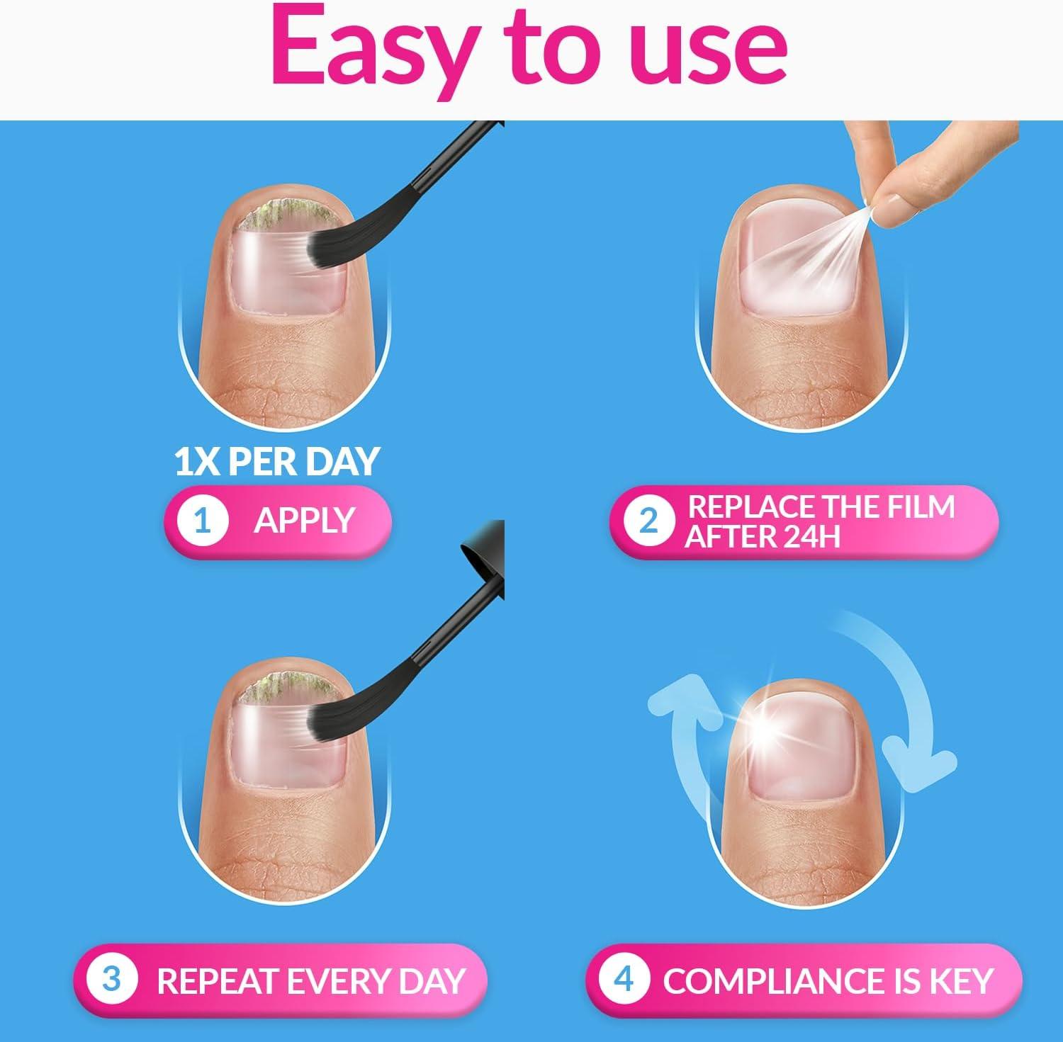 Excilor Nail Fungus Treatment ULTRA Extra Strong AntiFungal Nail