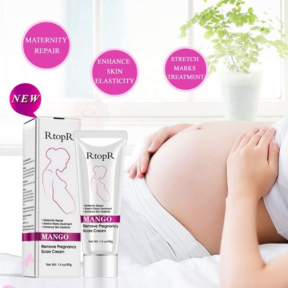 RtopR Mango Stretch Marks and Scar Cream -Stretch Marks and ...
