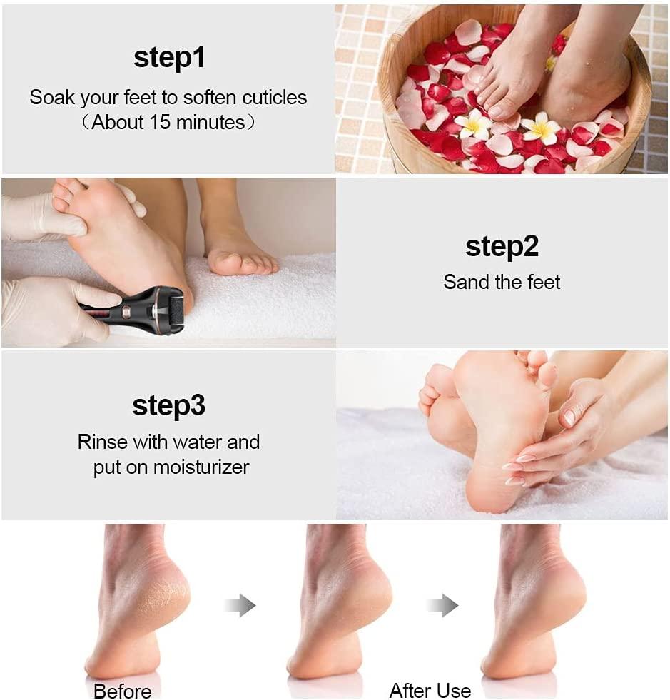 Dry cracked heels: causes, prevention, remedies and treatments | Dry cracked  heels, Cracked heels, Heel care