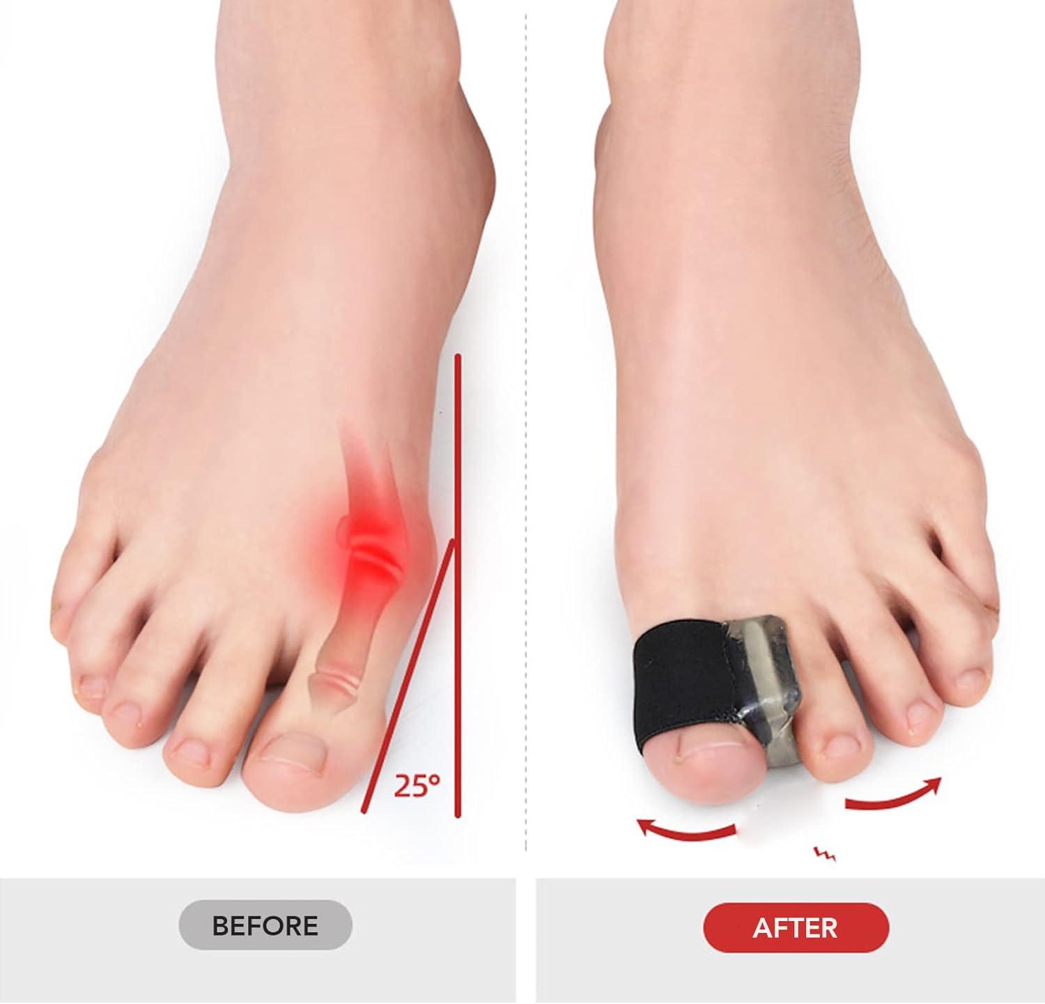 Toe Separators 6 Pairs Toe Spacers Separators Soft Flexible Overlapping