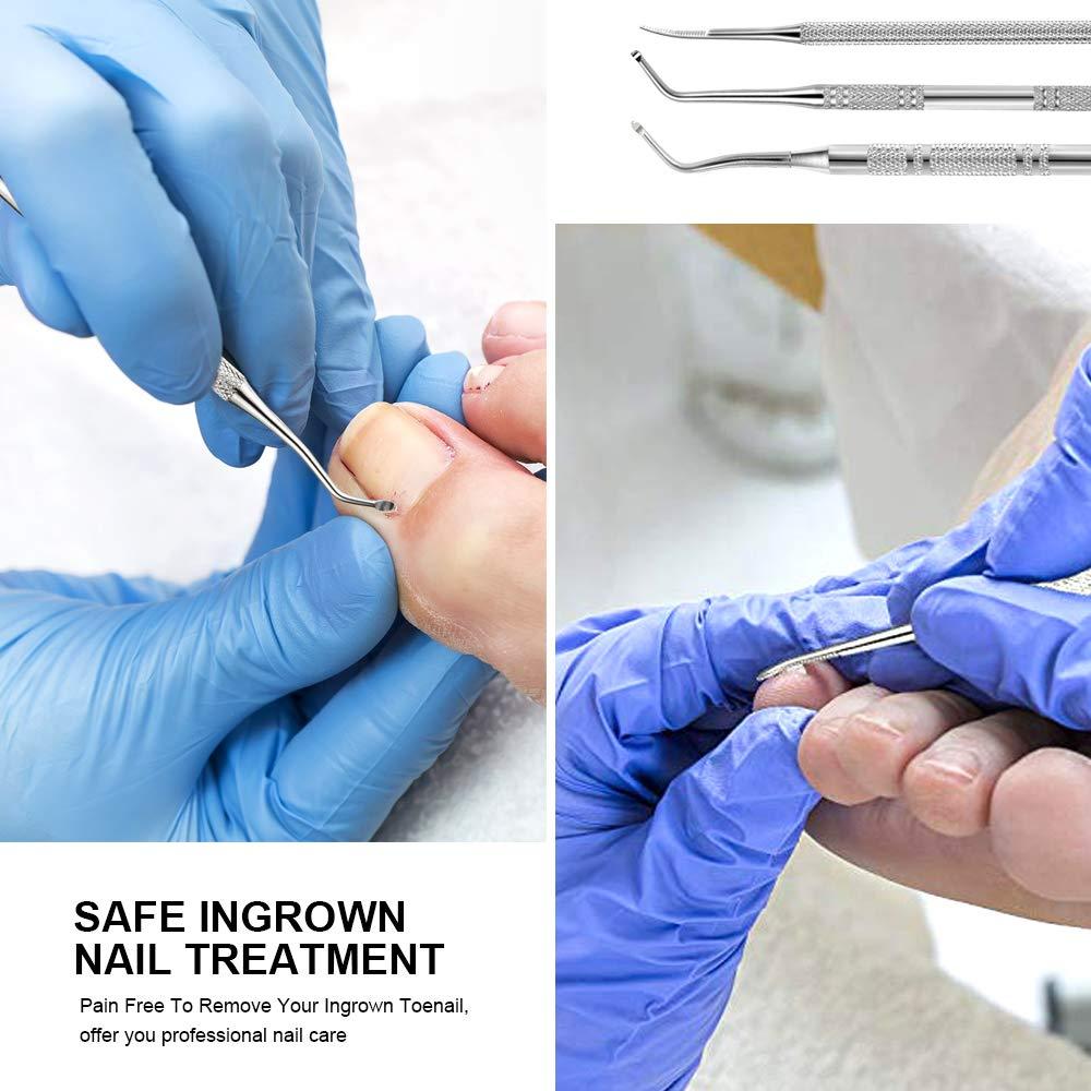 3pcs Ingrown toenail Tool, Toenail File and Lifters, Upgraded Teenitor