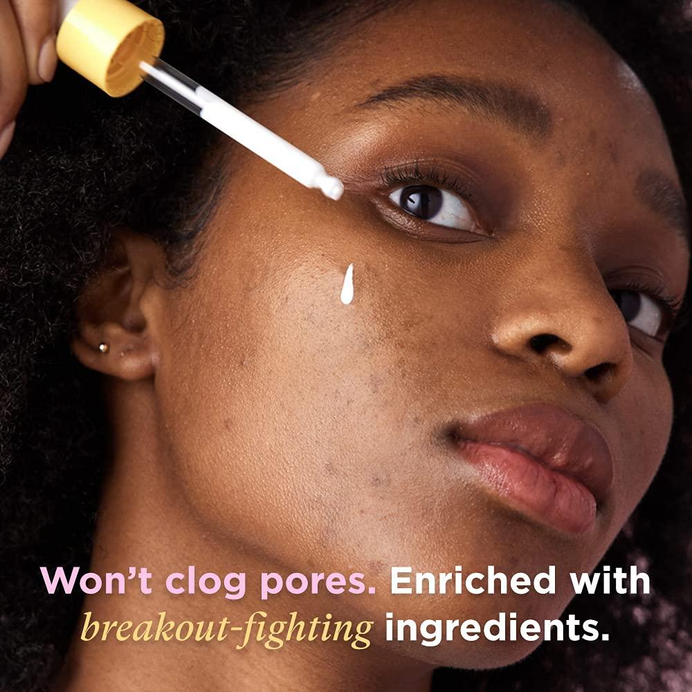 MEGASHADE by ZitSticka SPF 50 Facial Sunscreen Serum for Breakout