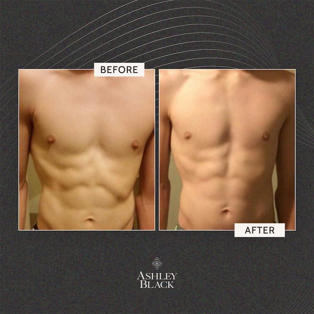 FasciaBlaster Muscles Kit by Ashley Black Patented Cellulite and