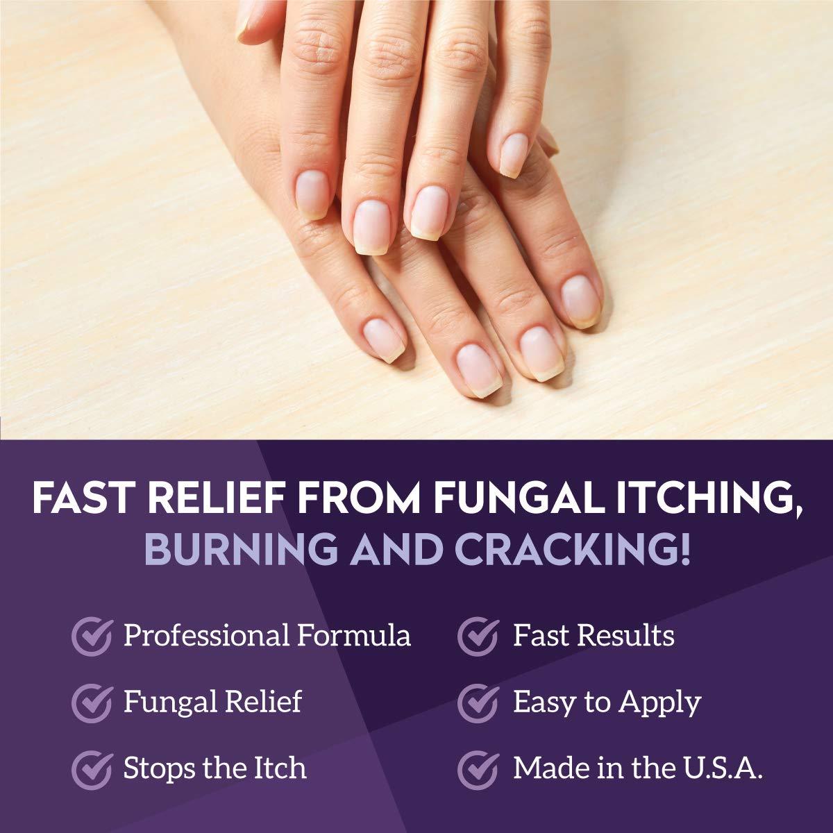 V20 Vite 20 Antifungal Cream Nail Fungus Killer for Hands and Feet