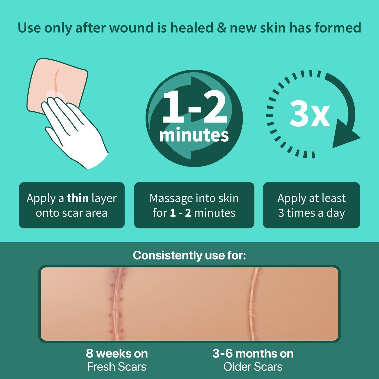 Ebanel Silicone Scar Gel with Onion Extract Emu Oil Vitamin E Medical