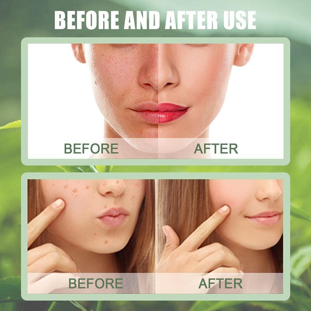 Green Tea Mask Stick for Face 4 PCS Sea Scouts Blackhead Remover Green Tea Deep Cleanse Mask for
