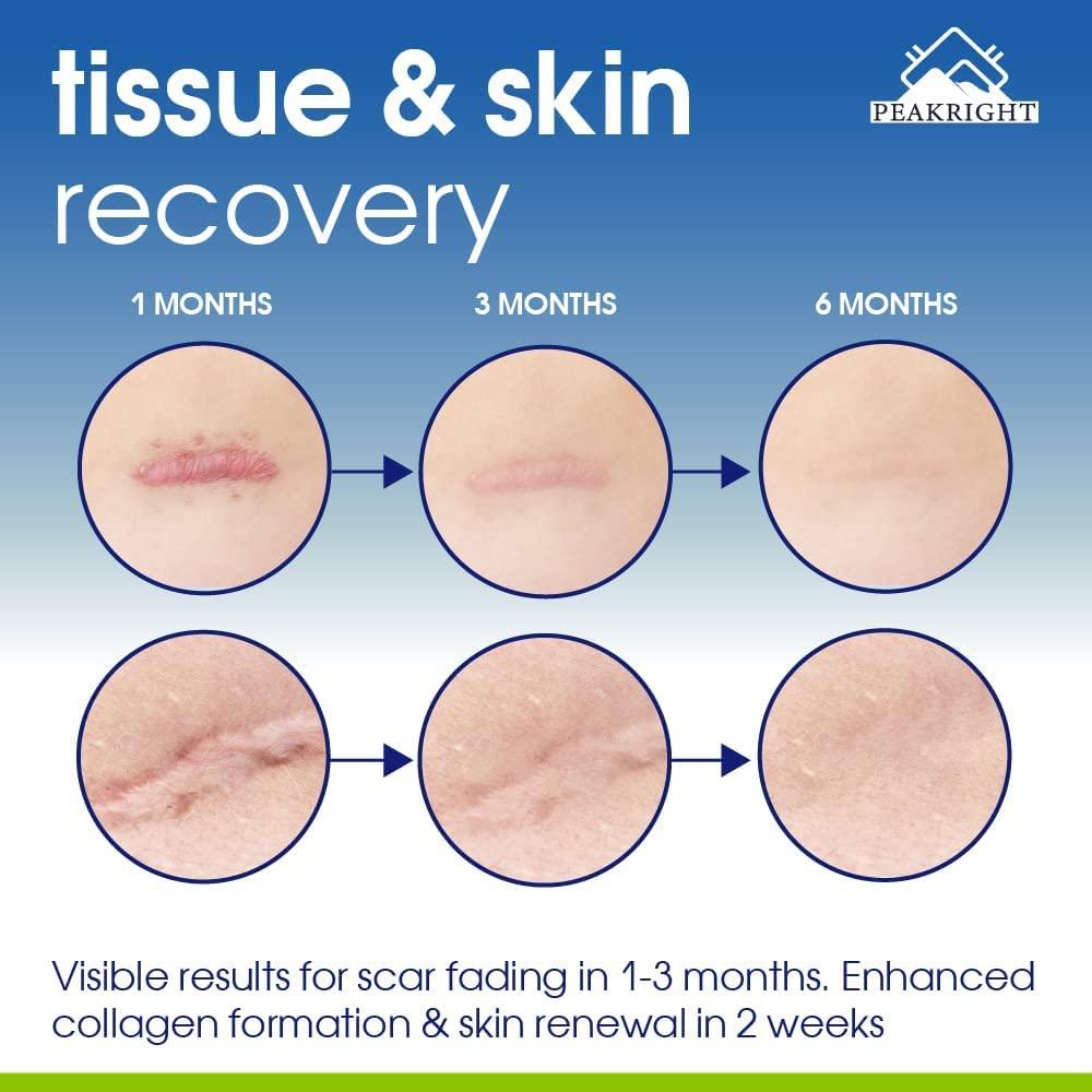 Wound Healing Scar Pills Made in USA for Surgery Recovery & Support