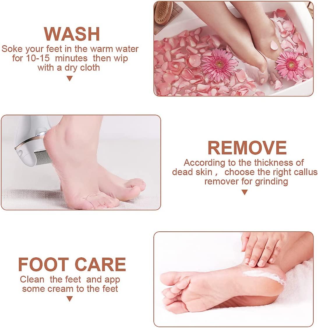 18 pc Electric Feet Callus Dead Skin Remover Professional Foot File  Pedicure Kit