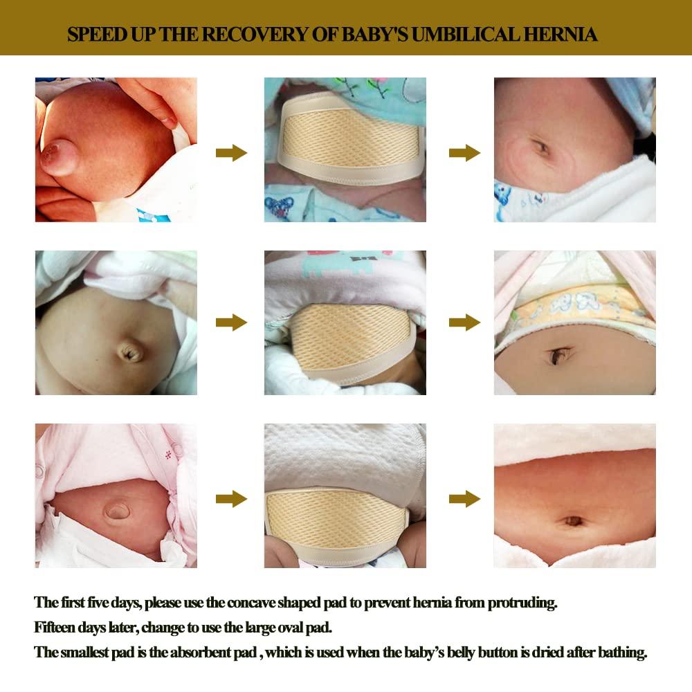 UMBILICAL HERNIA Belt for Children, Infant Abdominal Binder, Baby Navel  Truss Support (One Size)