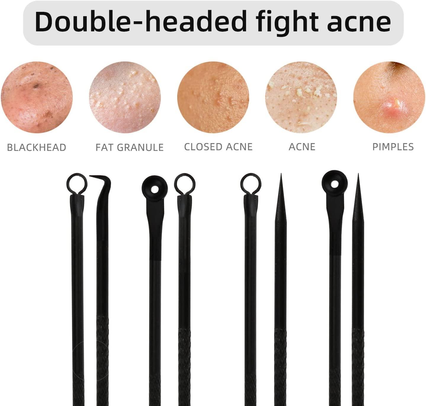 Dr Pimple Popper Skin Tag Removal Product Duduer Blackhead Remover Pimple Popper Tool Kit for Acne Extraction on