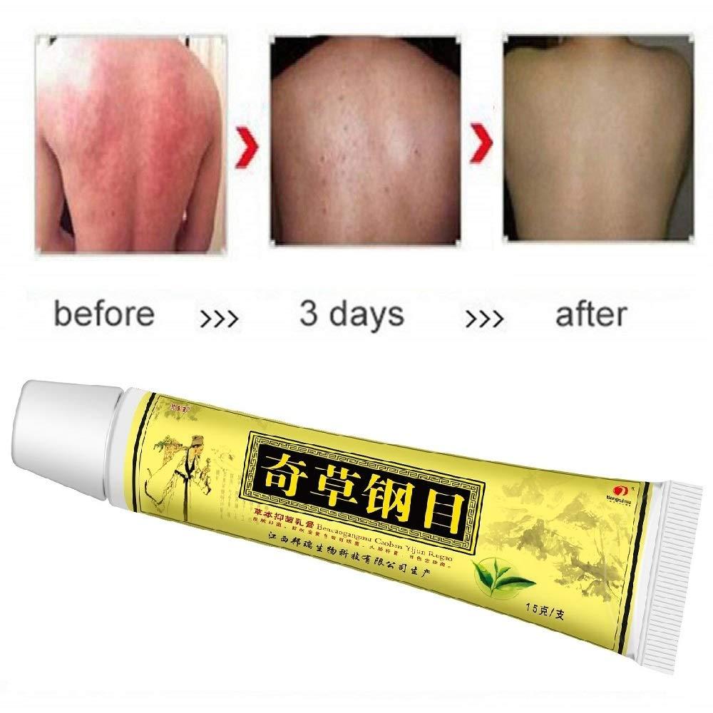 Navyue 5PCS Natural Chinese Herbal Cream for Eczema Psoriasis