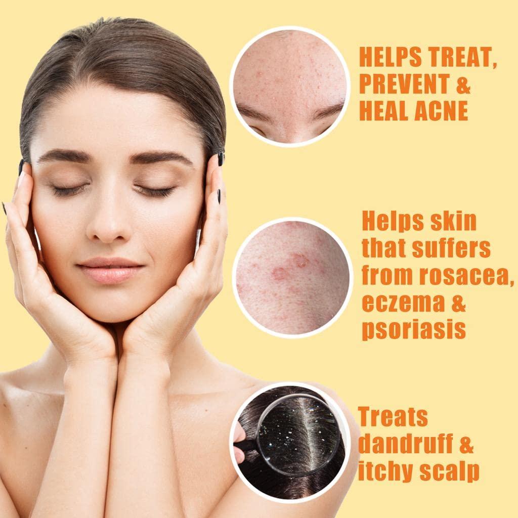 Cleansing 10 Sulfur Soap Bar for Face & Body Natural Shine Control