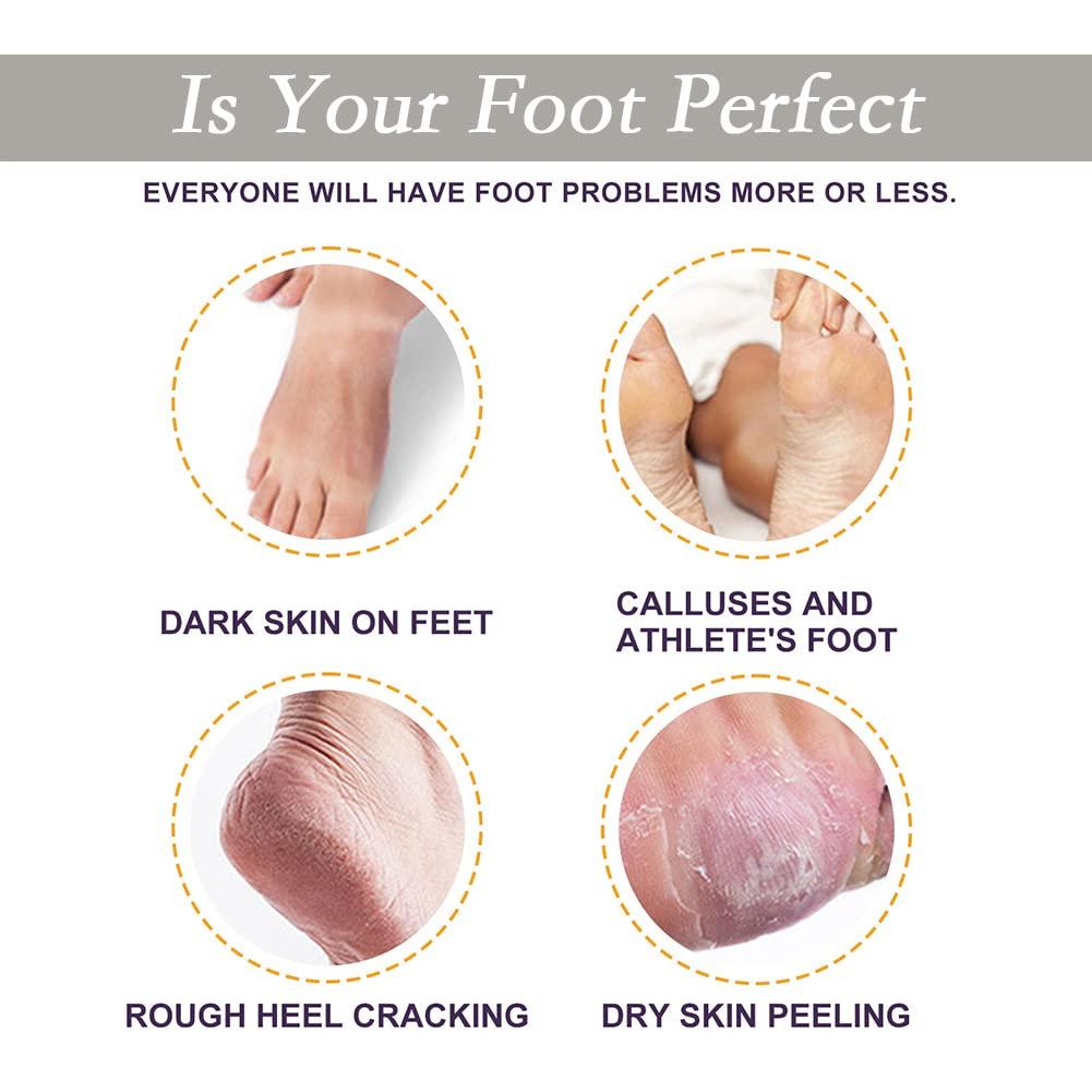 Retinol Foot Cream For Dry Cracked Dry Feet&heel,prevent Your Feet From  Cracking,make Your Feet Smooth And Soft,moisturize And Hydrate Your  Feet,callus And Dead Remover,cracked Heel Feet Cream - Temu