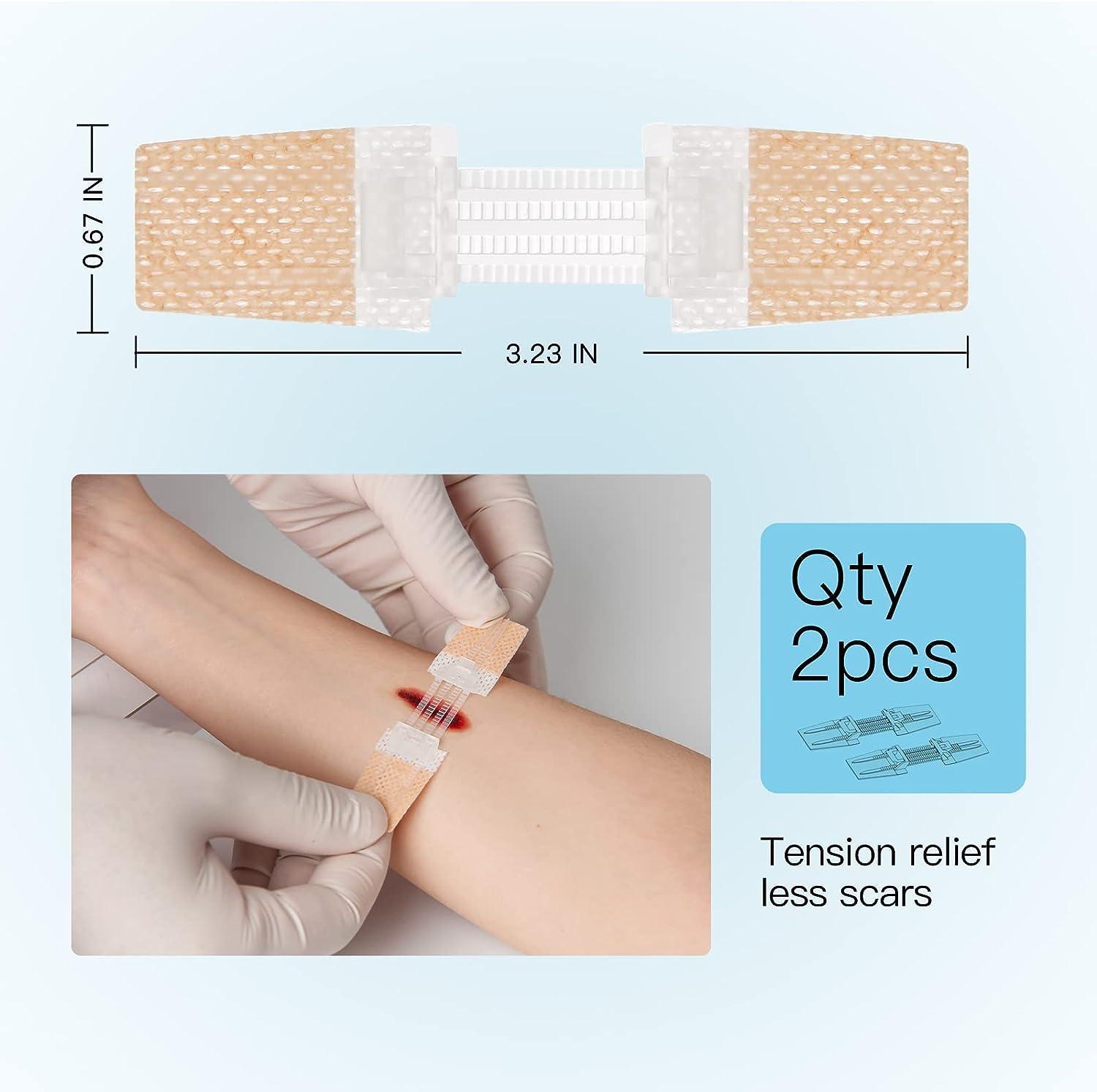 Zip Stitch Laceration Repair Without Stitches Quick Clot Emergency