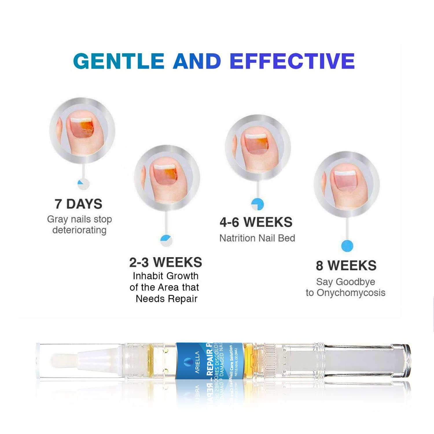 Ariella Nail Repair Pens for Toenail and Fingernail, Maximum Strength