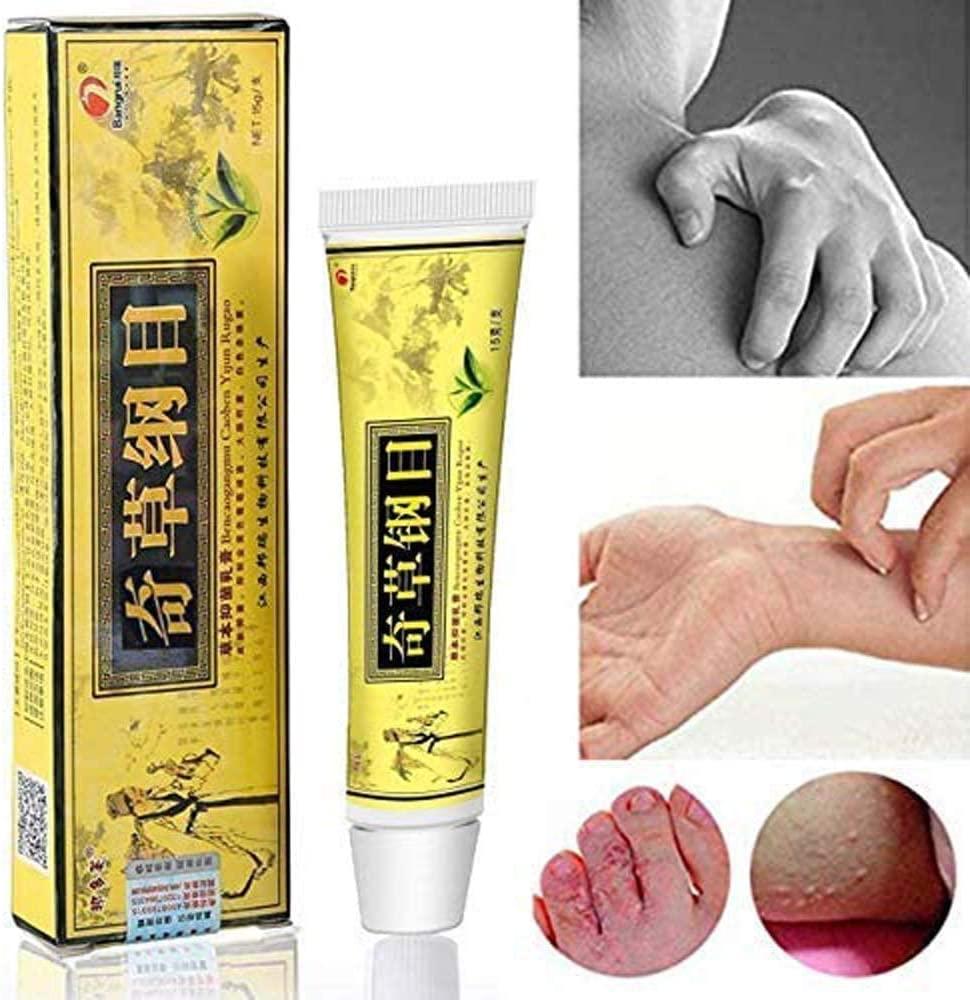 6PCS Chinese Herbal Eczema Psoriasis Creams for Dermatitis & Pruritus CEZUBEM Ointment