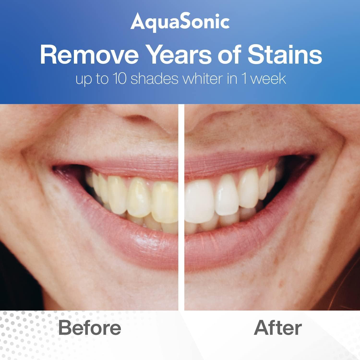 AquaSonic Teeth Whitening Kit - Thumbnail 5