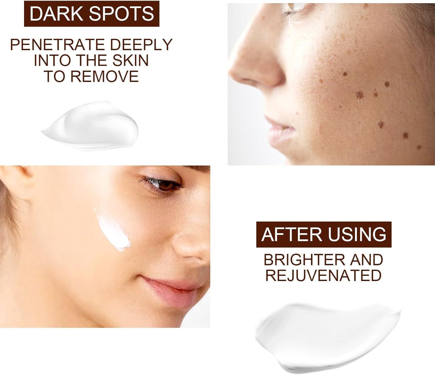 glutathione essence How Glutathione Helps to Remove Dark Circles
