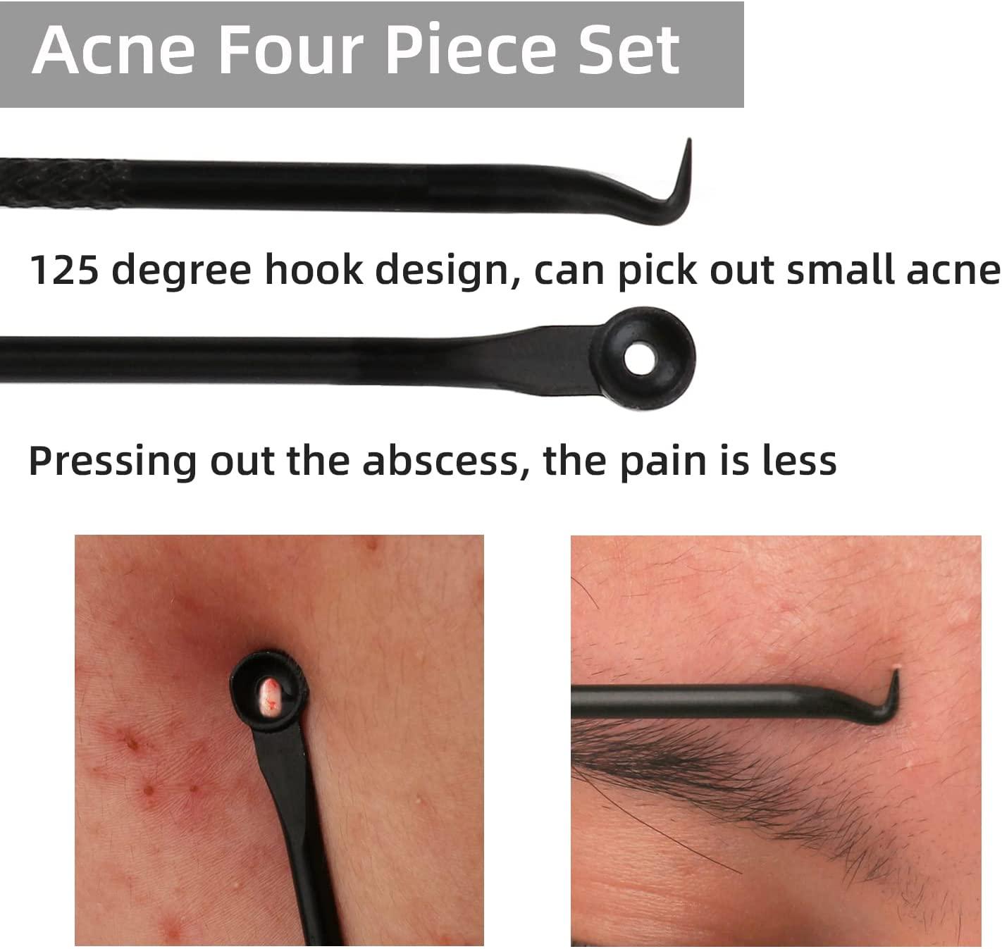 Duduer Blackhead Remover Pimple Popper Tool Kit for Acne Extraction on Nose and Face