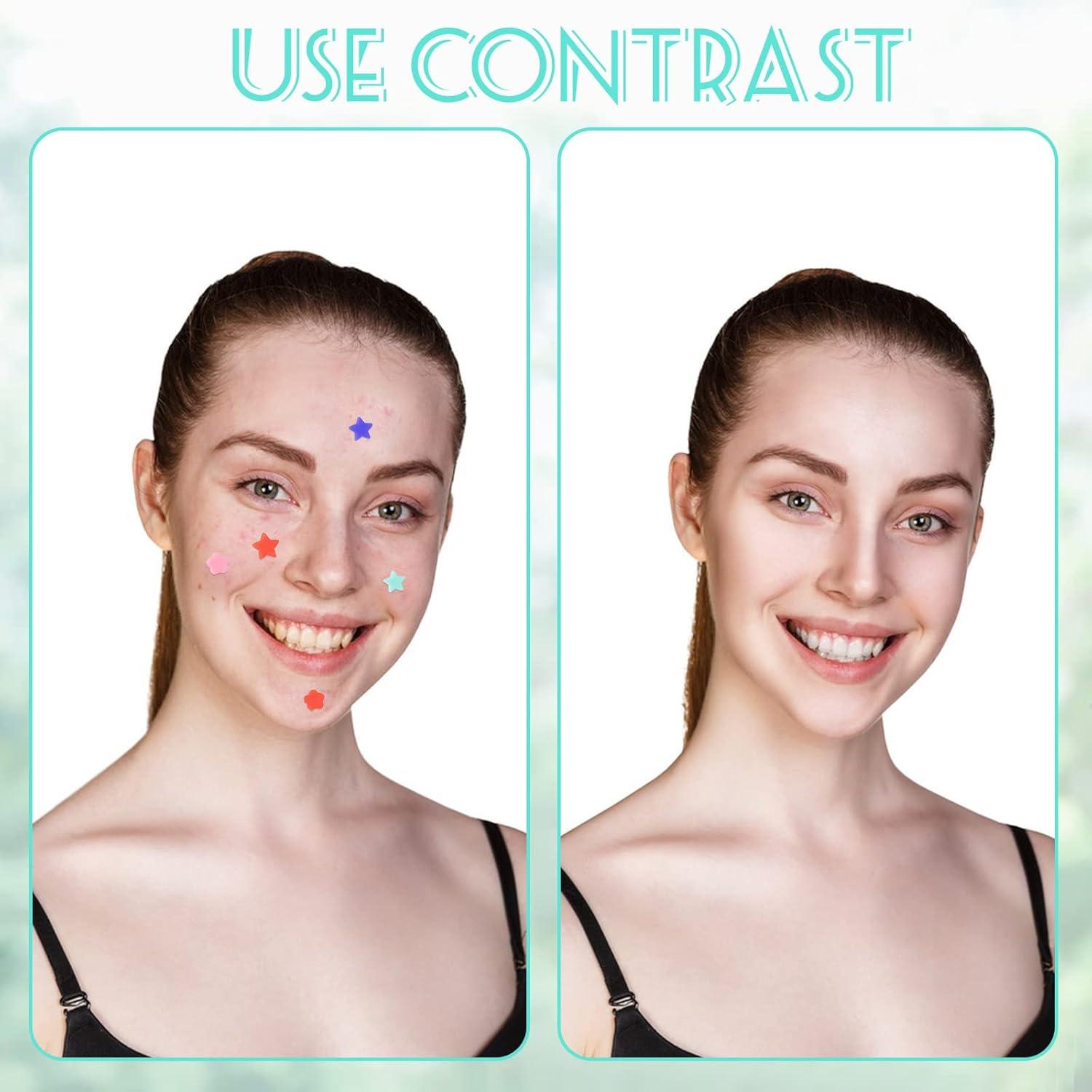 LuckyOpt Hydrocolloid Dressing Acne Patch 2Pieces(40Dots) Star Face Pimple  Patches to Absorbs Oil Moisturizes Calms & Relieves Acne First Aid for  Covering Bacne and Pimples (multicolor) | Buy Now with Express International