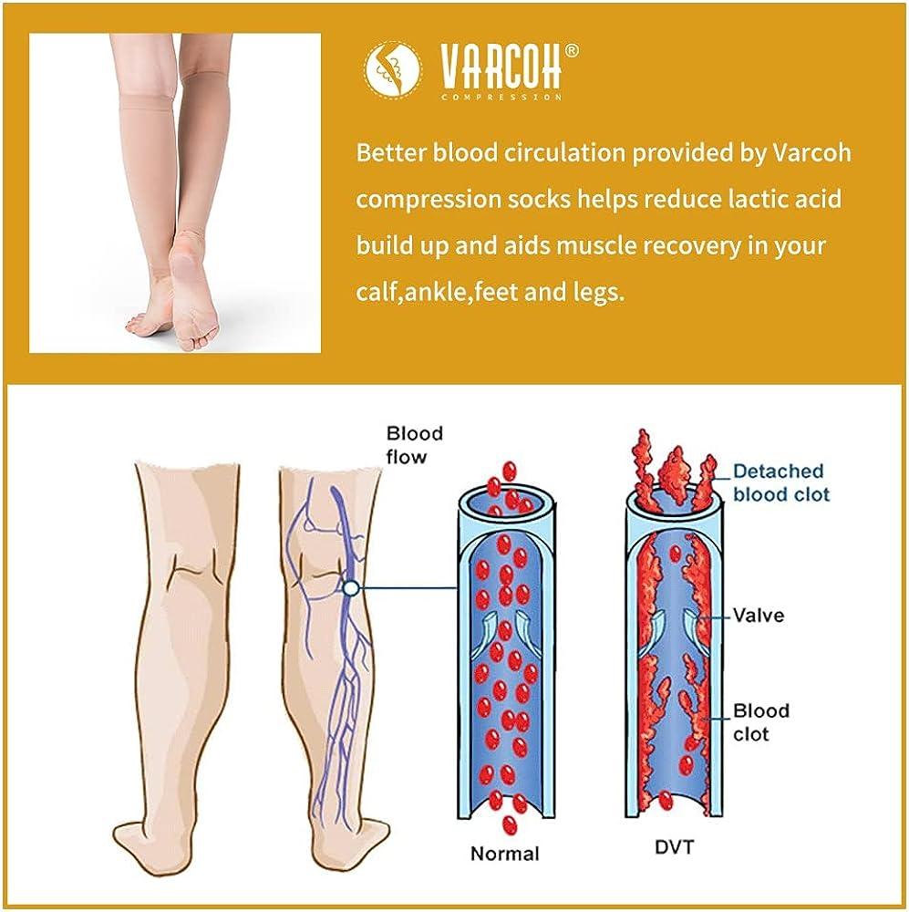 Lactic acid build outlet up in calves