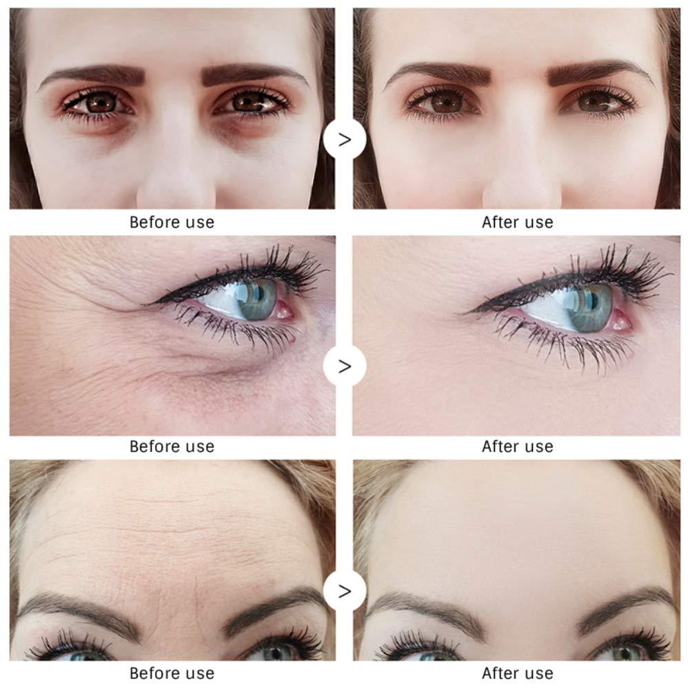 OMY LADY Ageless Real Eyes Cream Anti Aging Bags & Dark Circle Instant