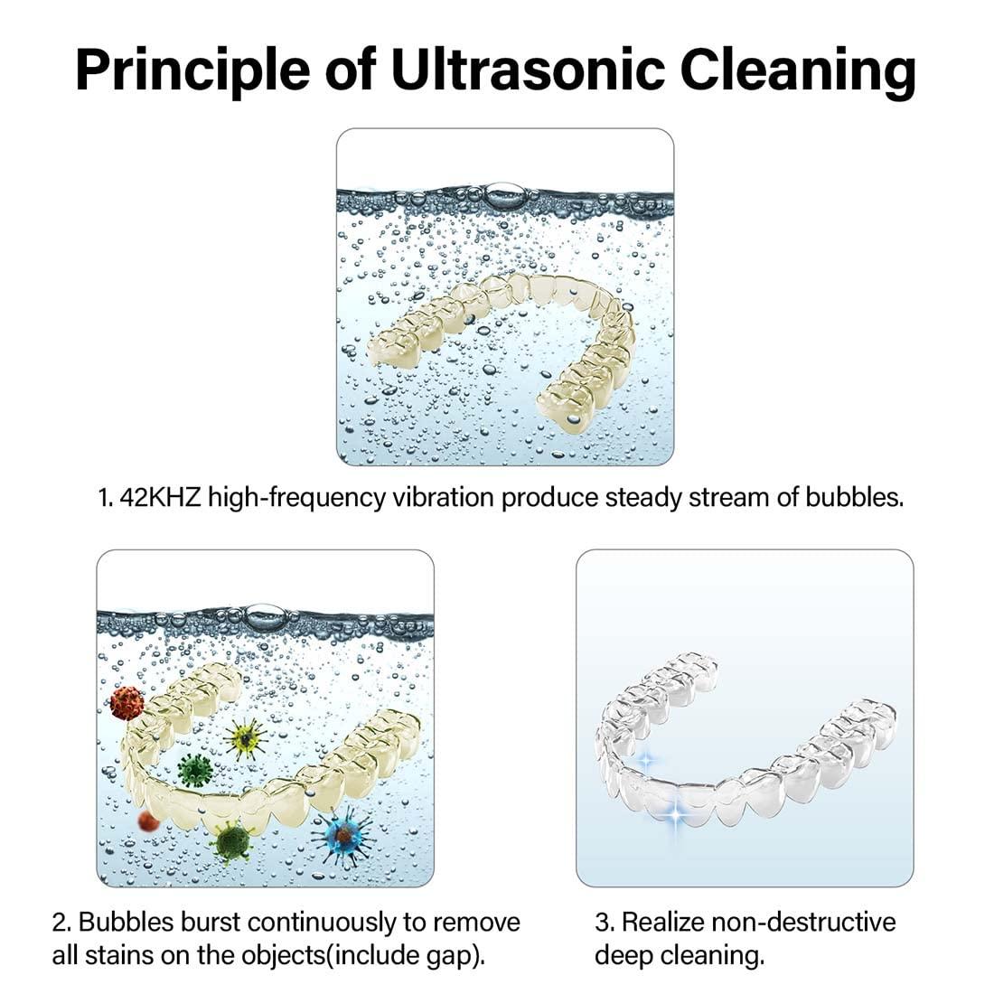 Anbbas Denture Bath Cleaning Machine with Basket,Mini Brush,Ultrasonic