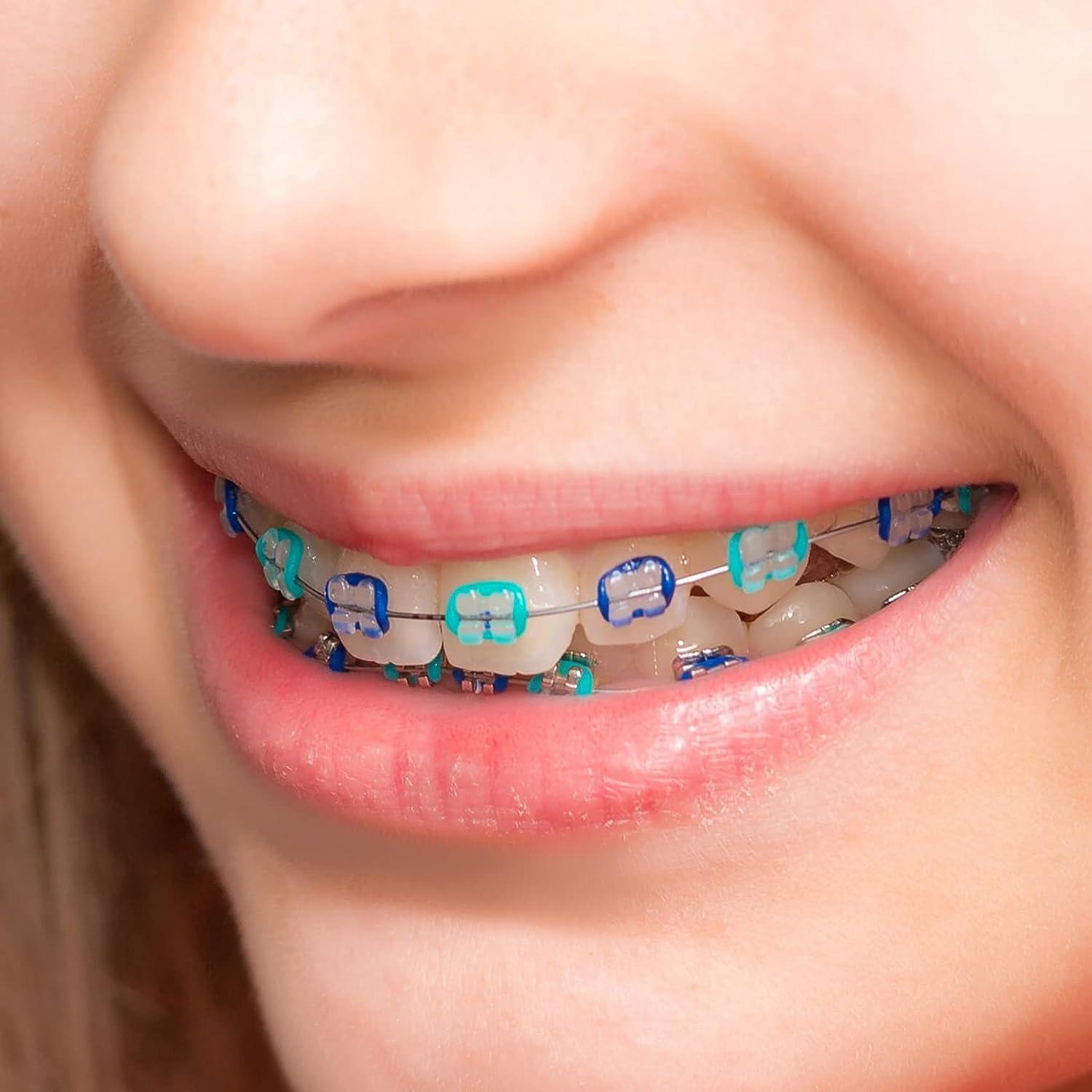 1040 Pink Dental Ligature Rubber Ties Bands Braces Orthodontic