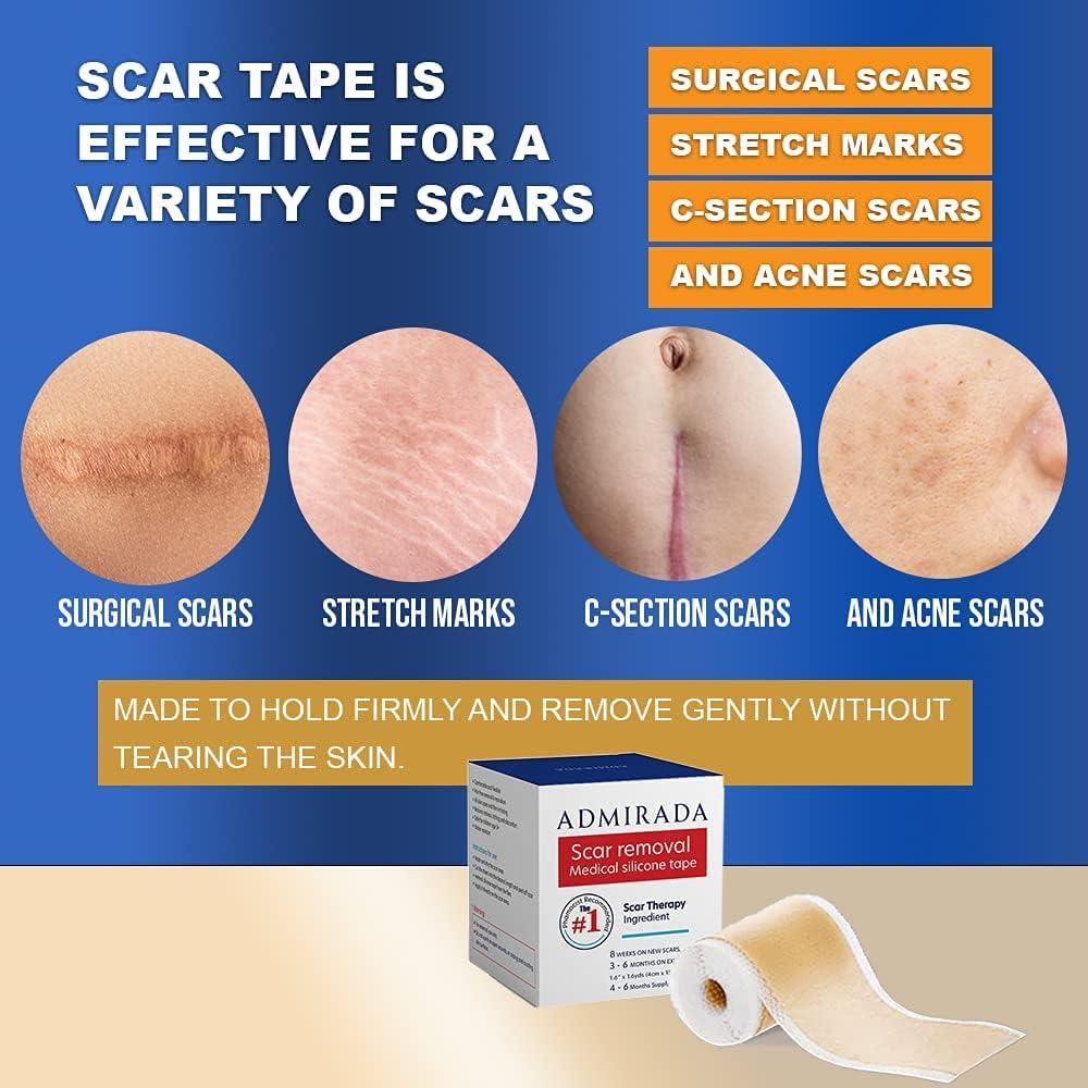 Scar Tape Silicone Scar Remover Sheets With Silicone Scar Gel For